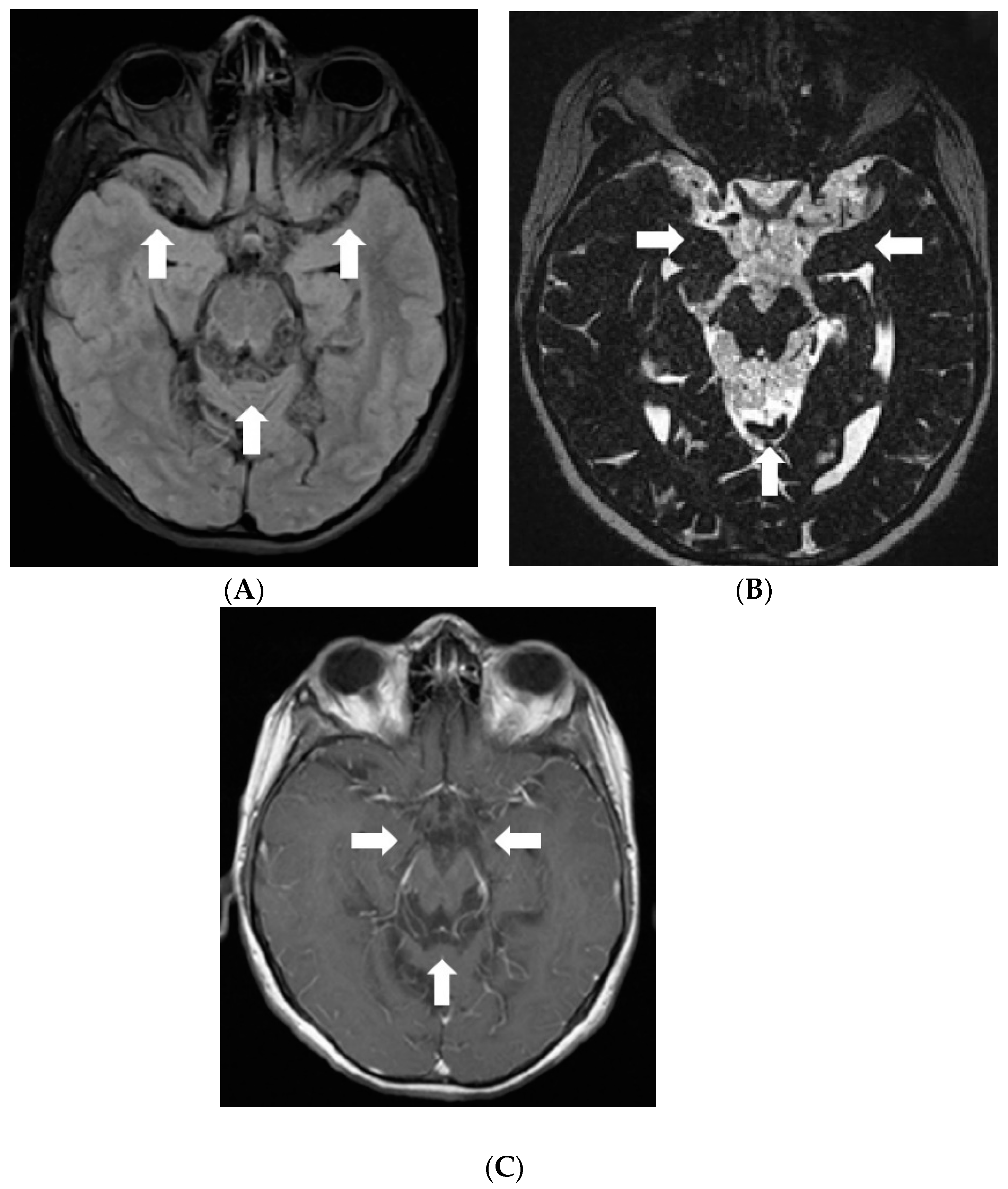 Diagnostics 12 00342 g003 550