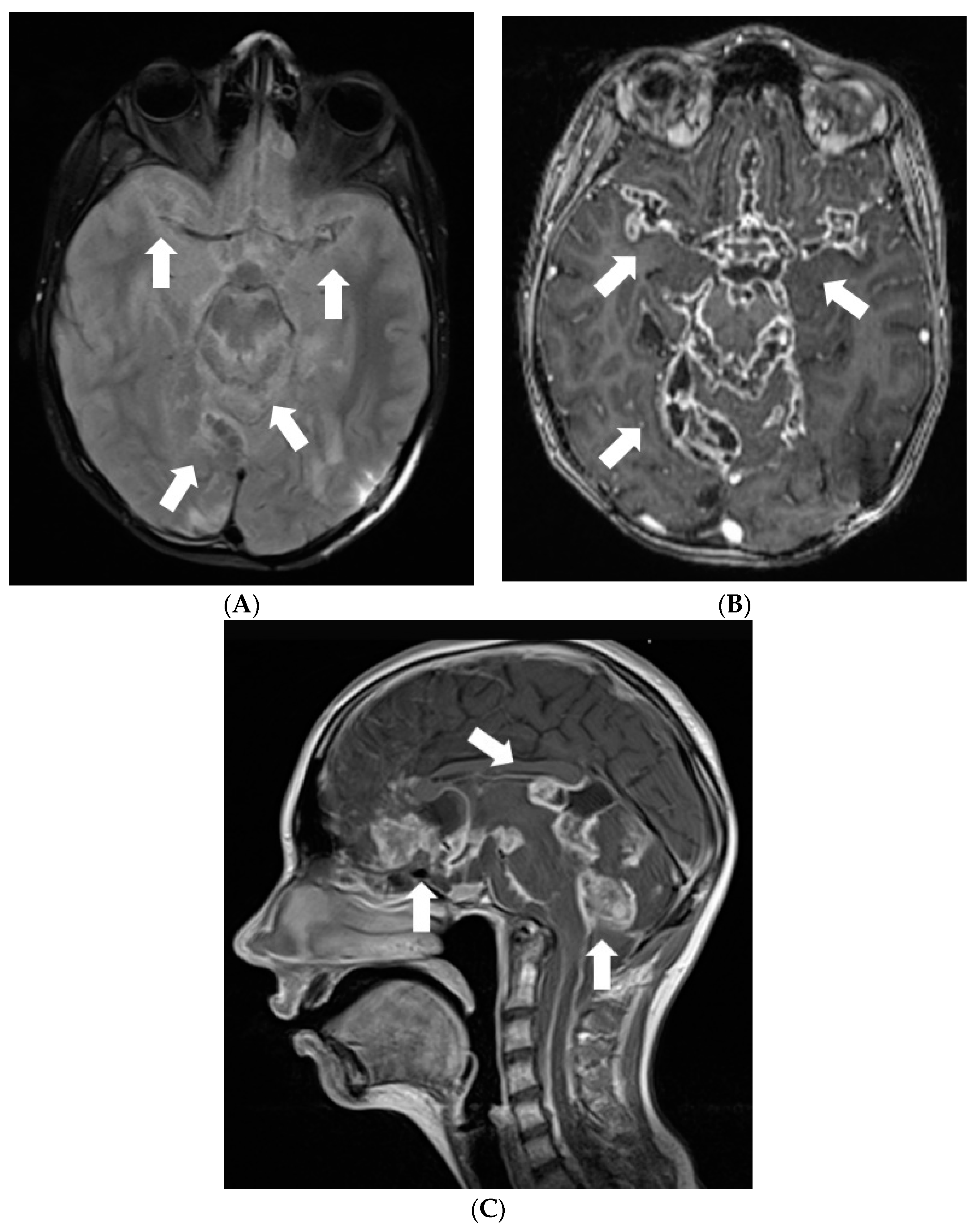 Diagnostics 12 00342 g004 550