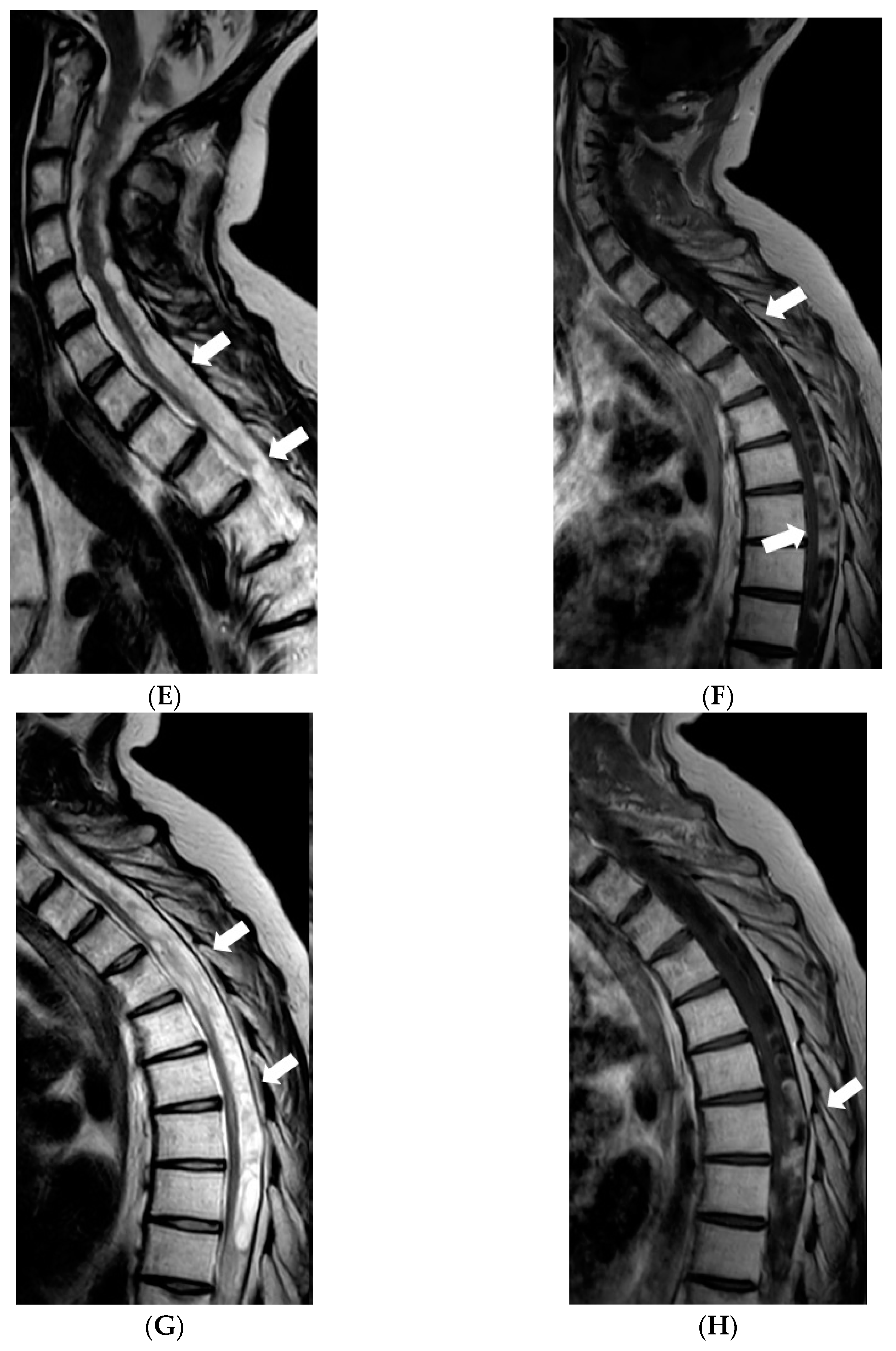 Diagnostics 12 00342 g006b 550