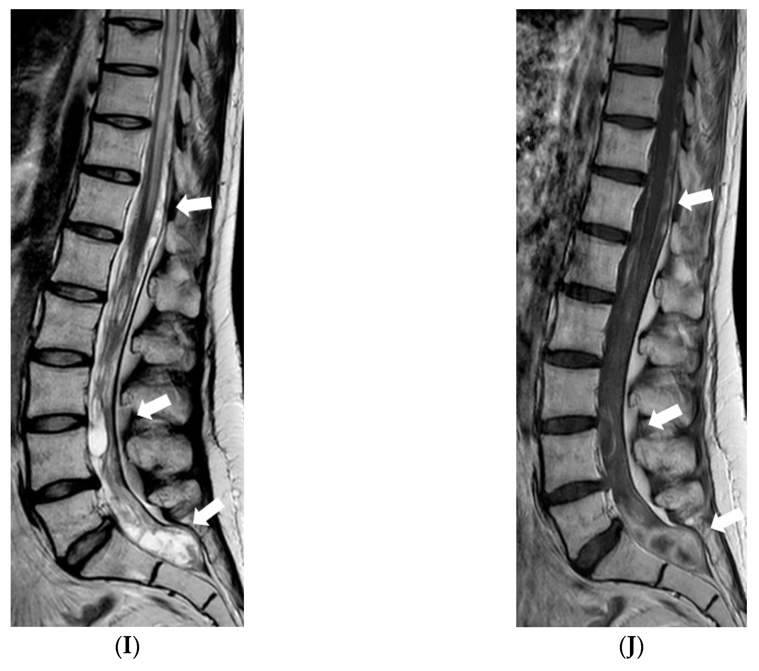 Diagnostics 12 00342 g006c 550