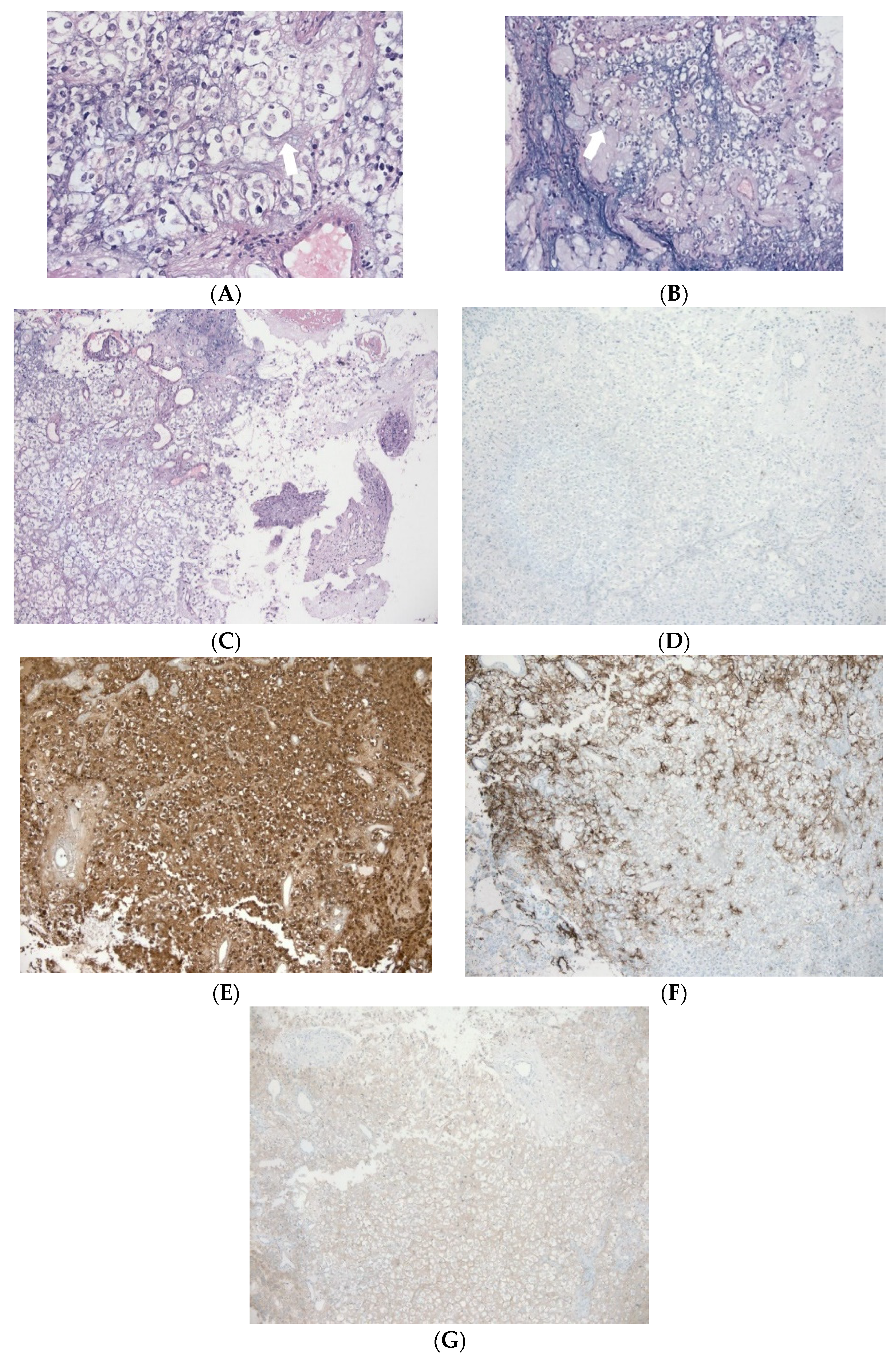 Diagnostics 12 00342 g007 550