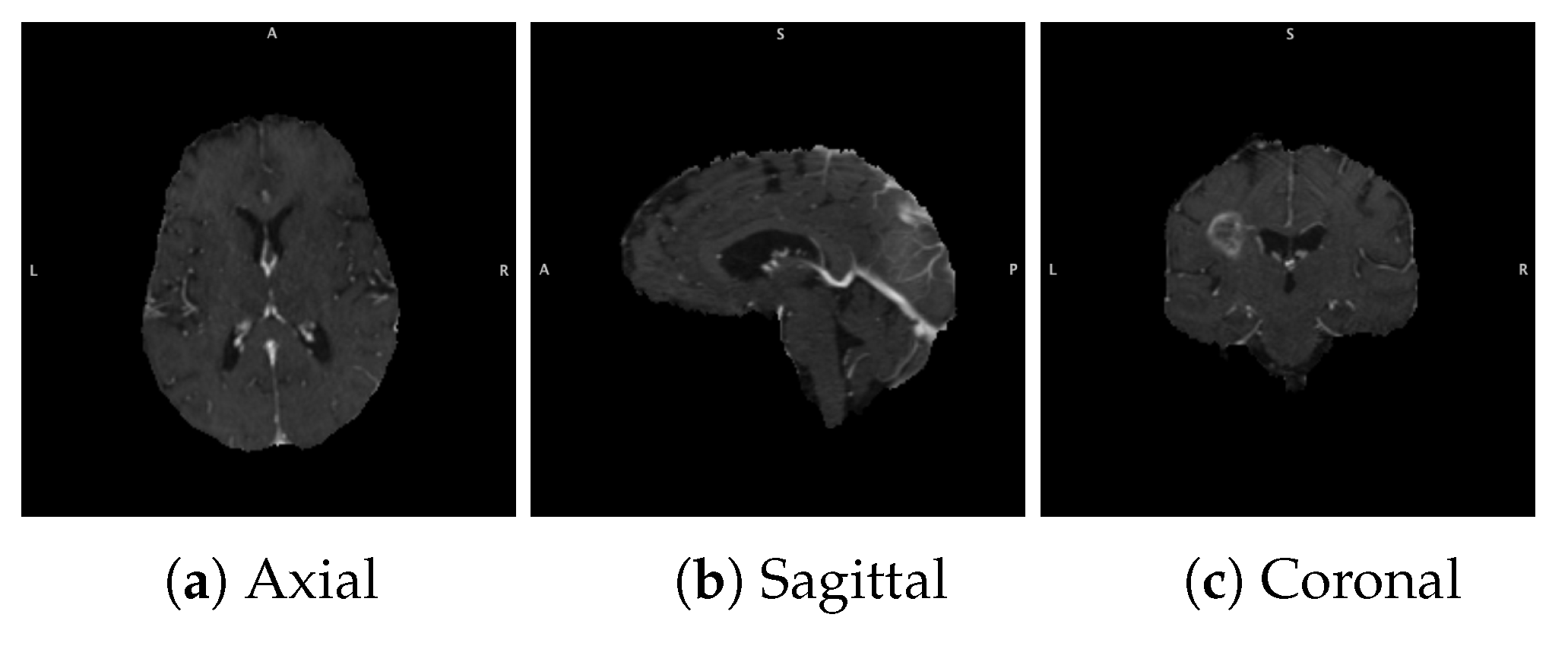 Diagnostics 12 00345 g001