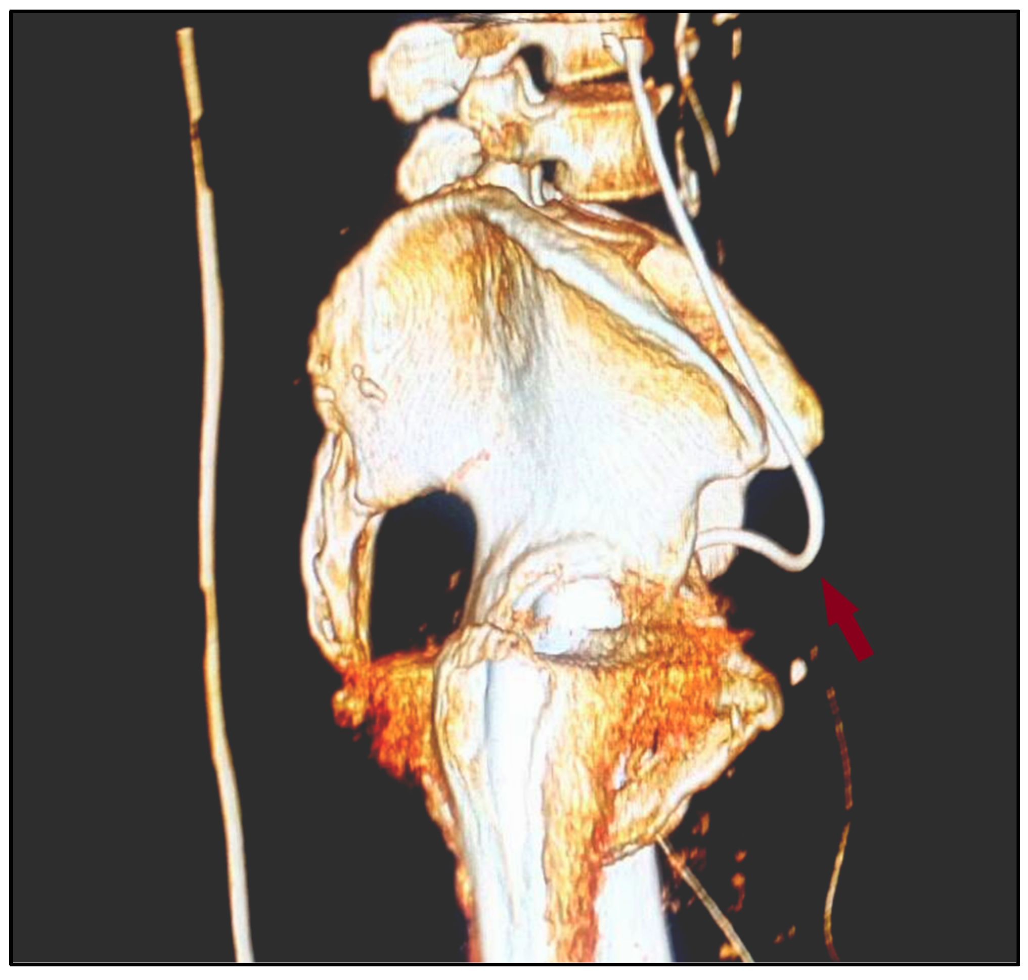 Diagnostics 12 00353 g003 Diagnostics 12 00353 g003