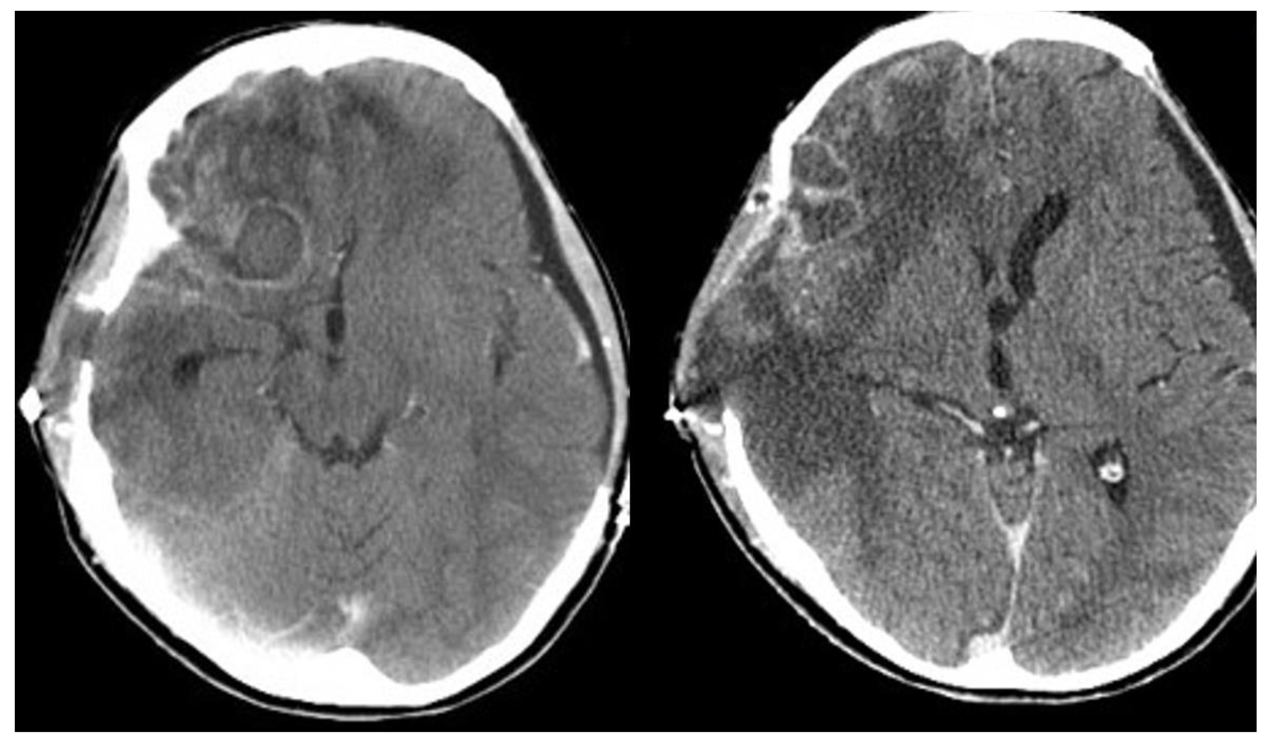 Diagnostics 12 00358 g002