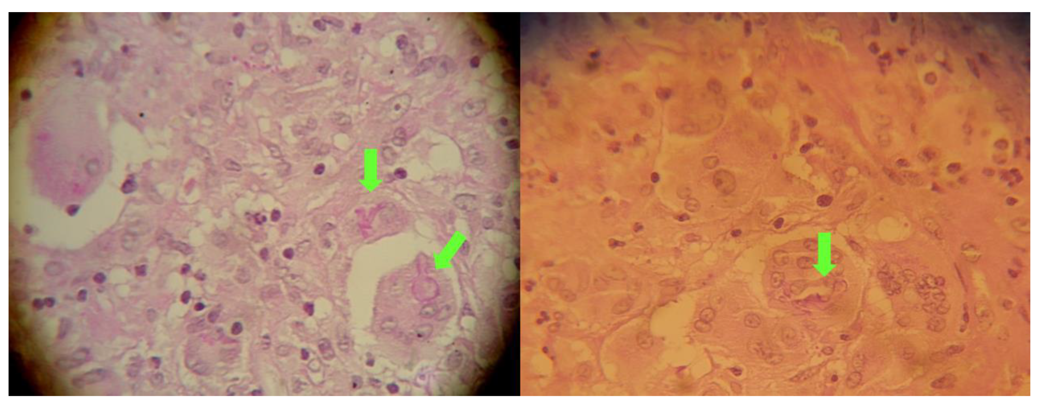 Diagnostics 12 00358 g003