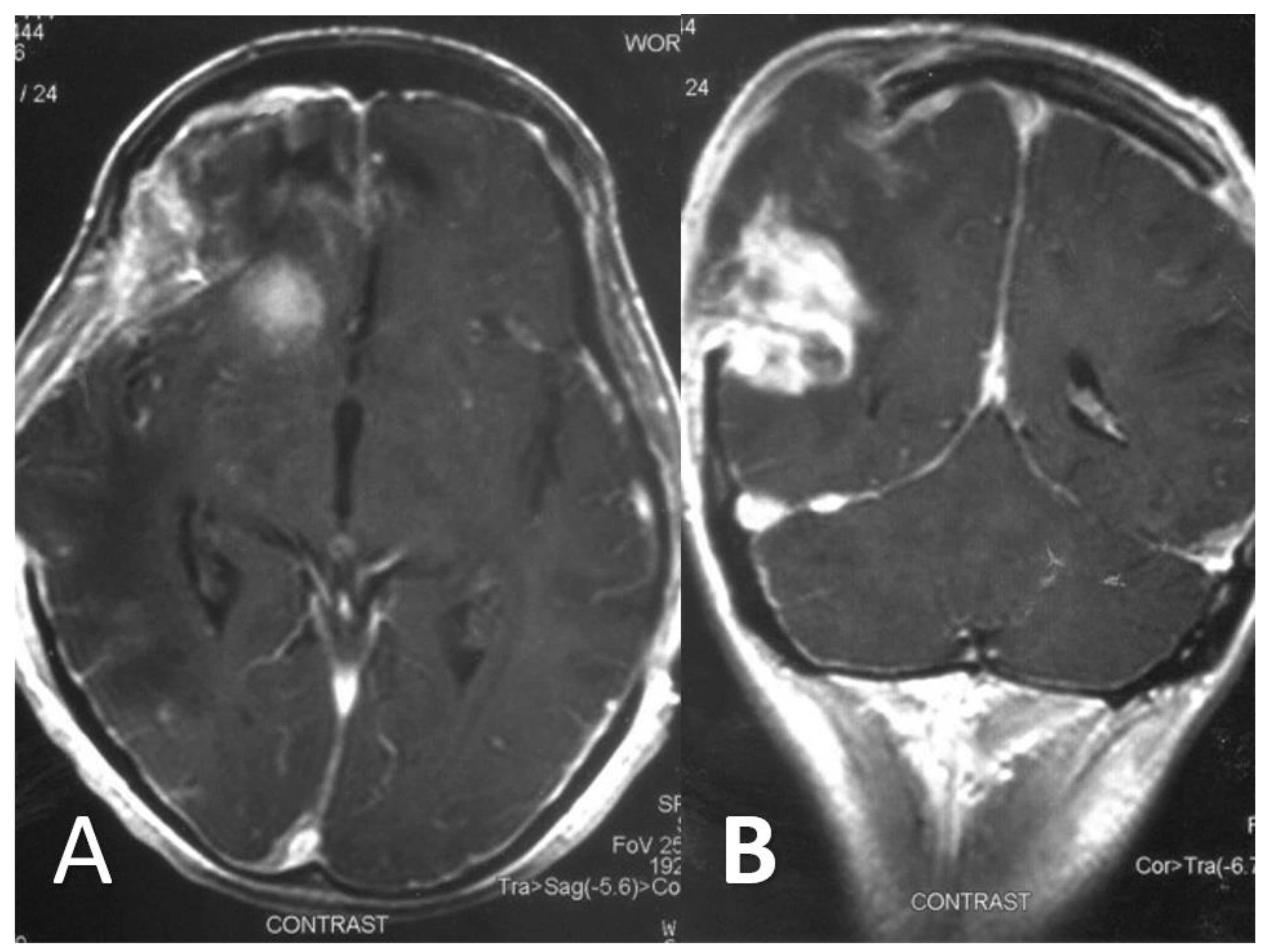 Diagnostics 12 00358 g004