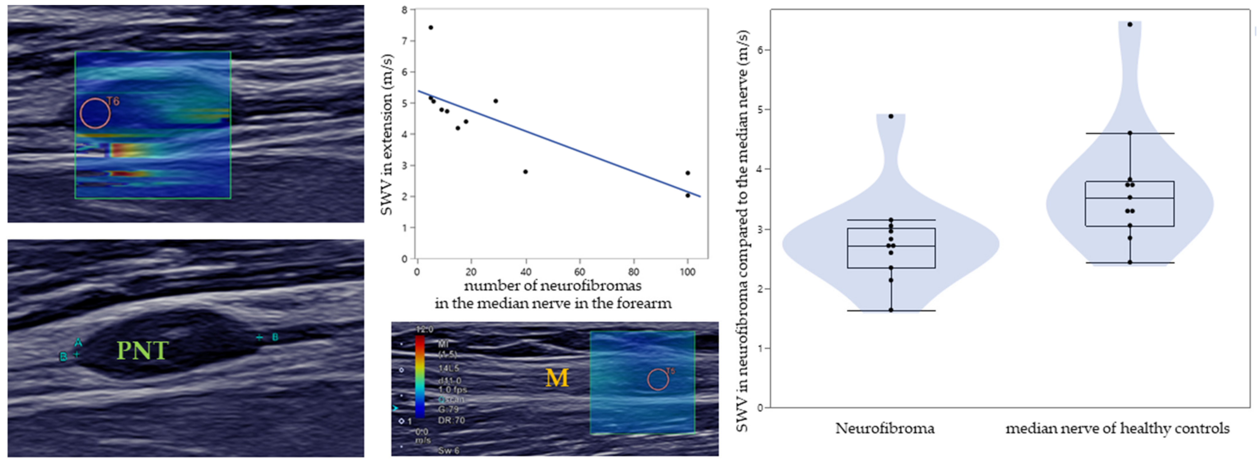 Diagnostics 12 00360 g001