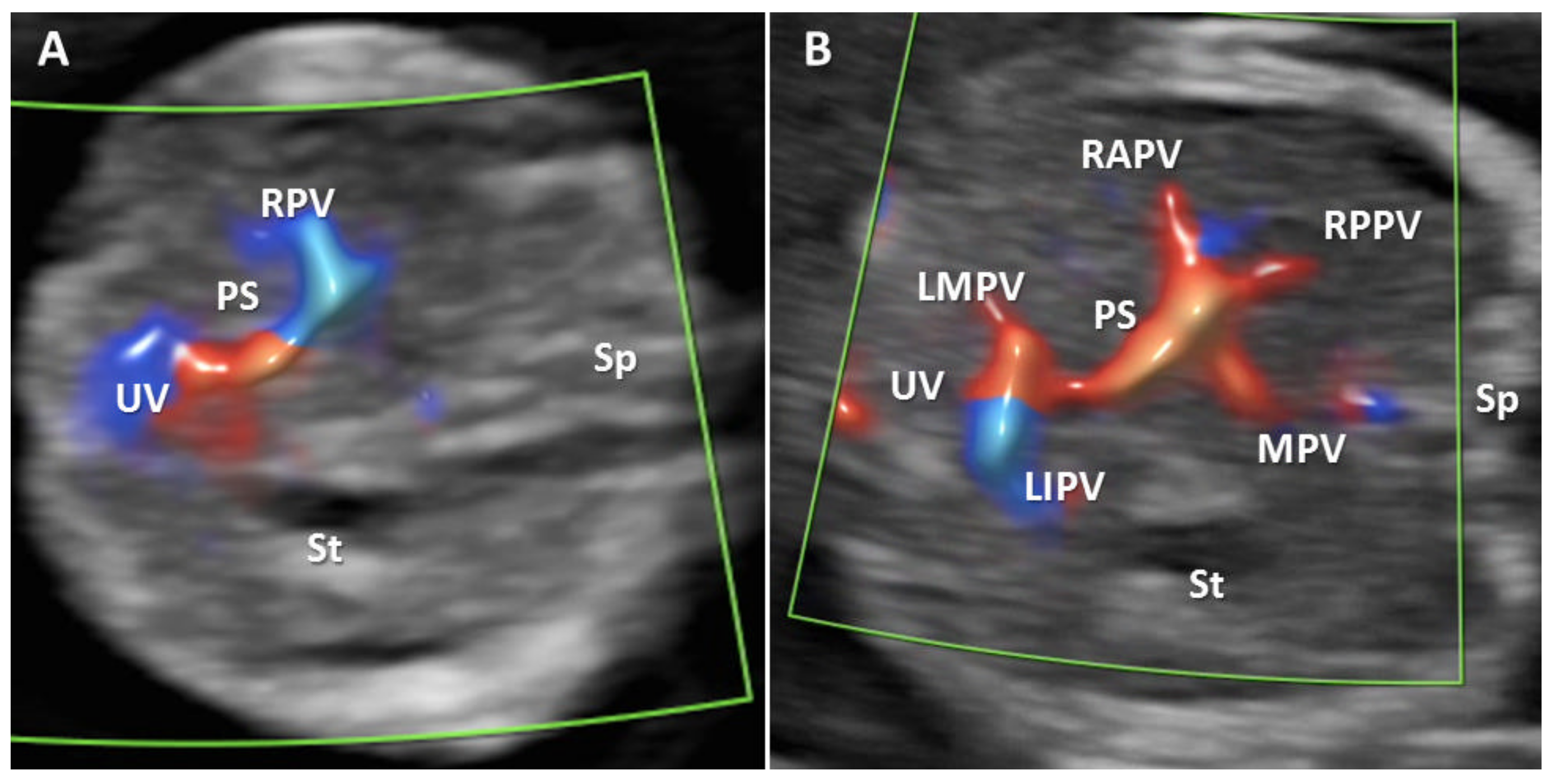 Diagnostics 12 00361 g002 550