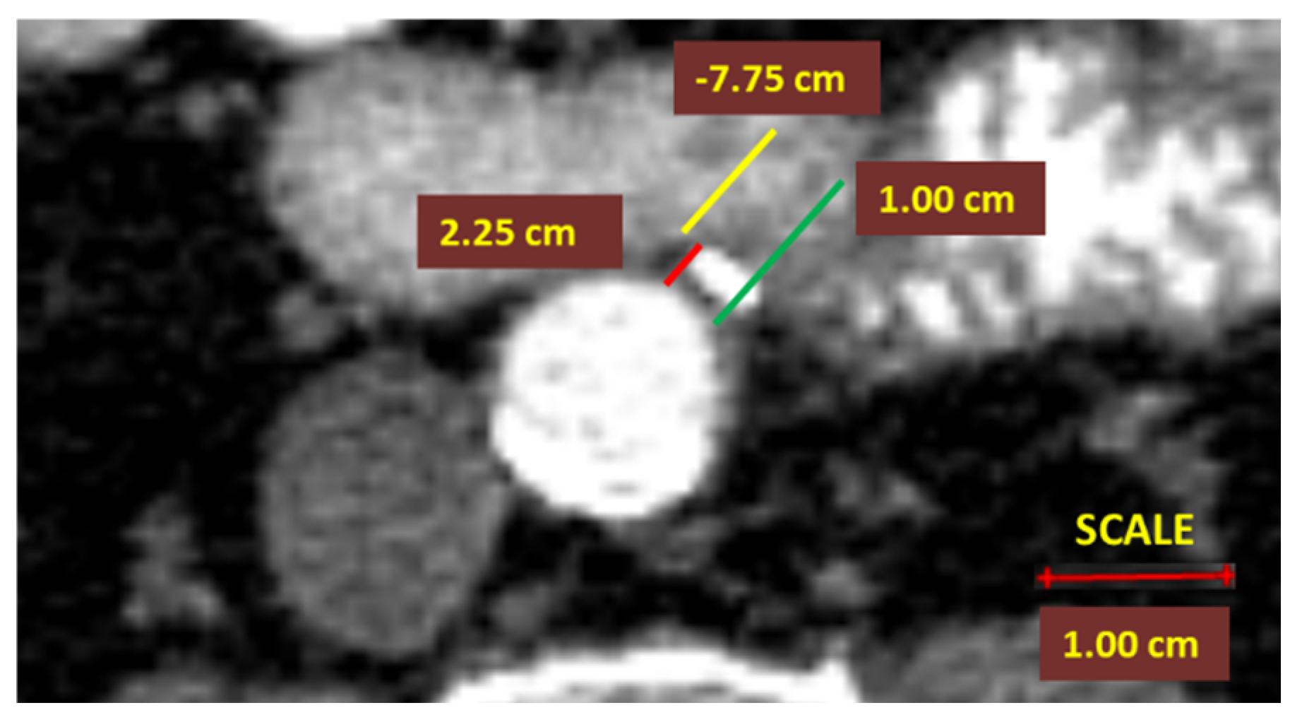 Diagnostics 12 00363 g004