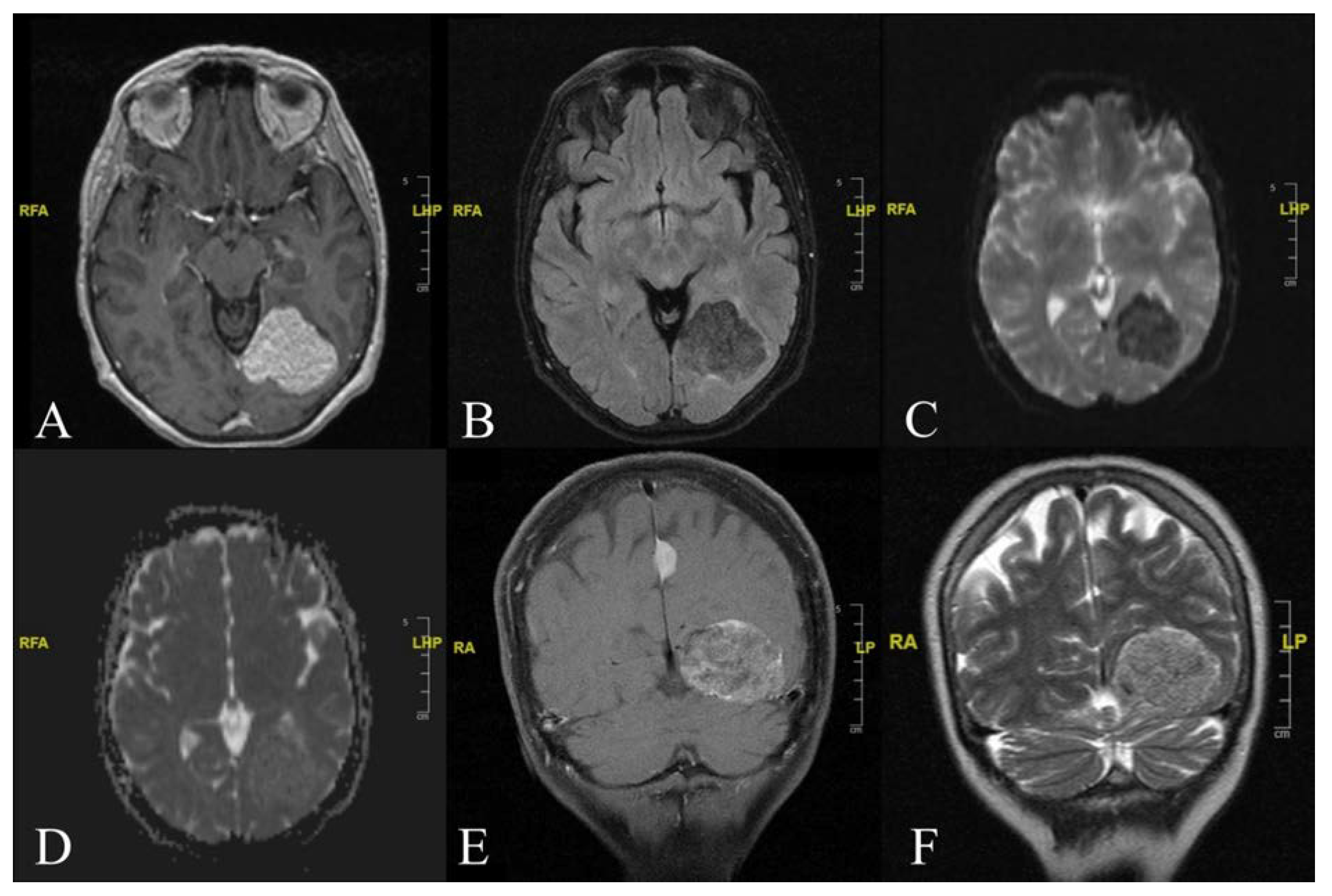 Diagnostics 12 00365 g001 Diagnostics 12 00365 g001
