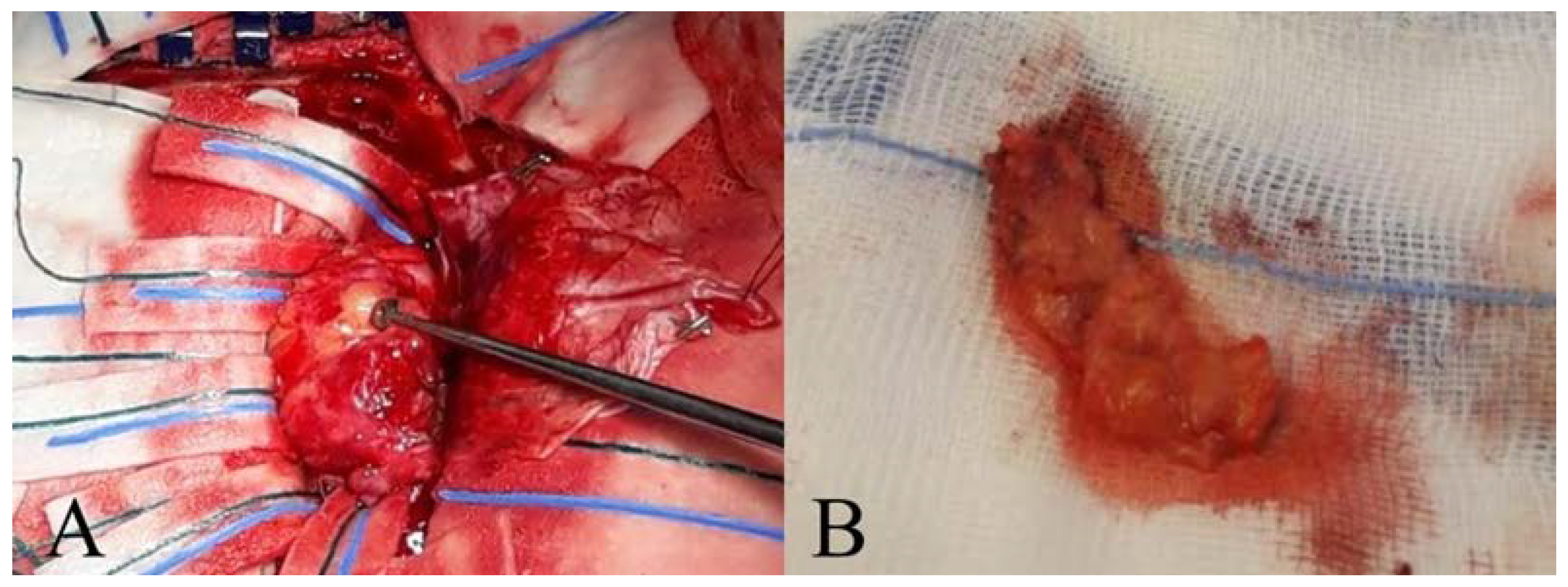 Diagnostics 12 00365 g002 Diagnostics 12 00365 g002