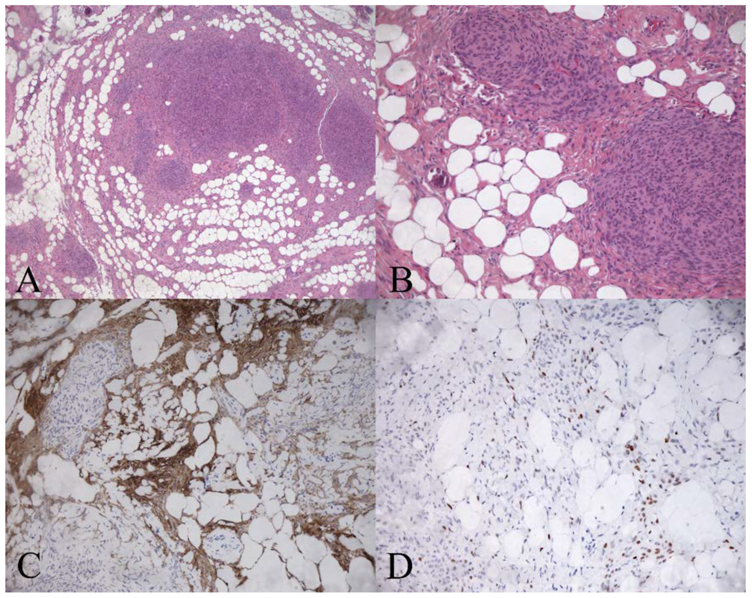 Diagnostics 12 00365 g003 Diagnostics 12 00365 g003