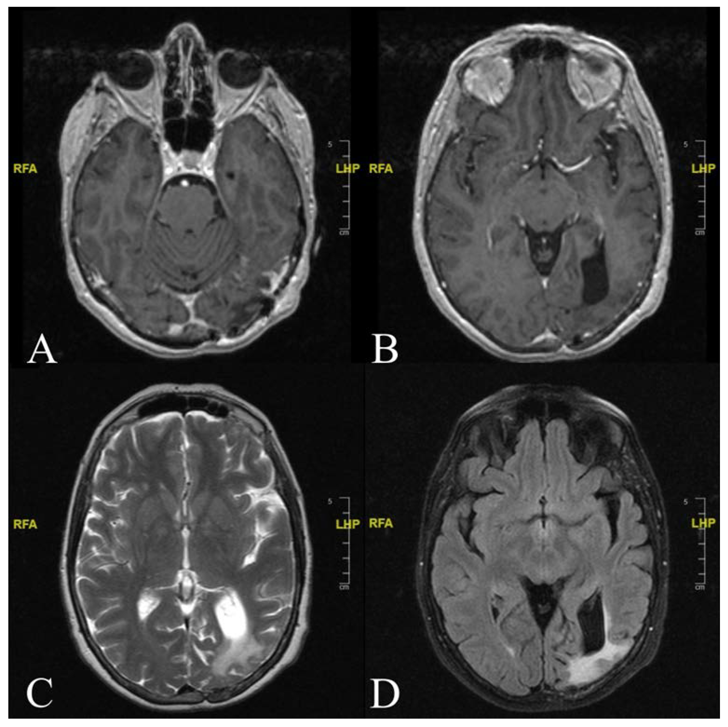 Diagnostics 12 00365 g004 Diagnostics 12 00365 g004