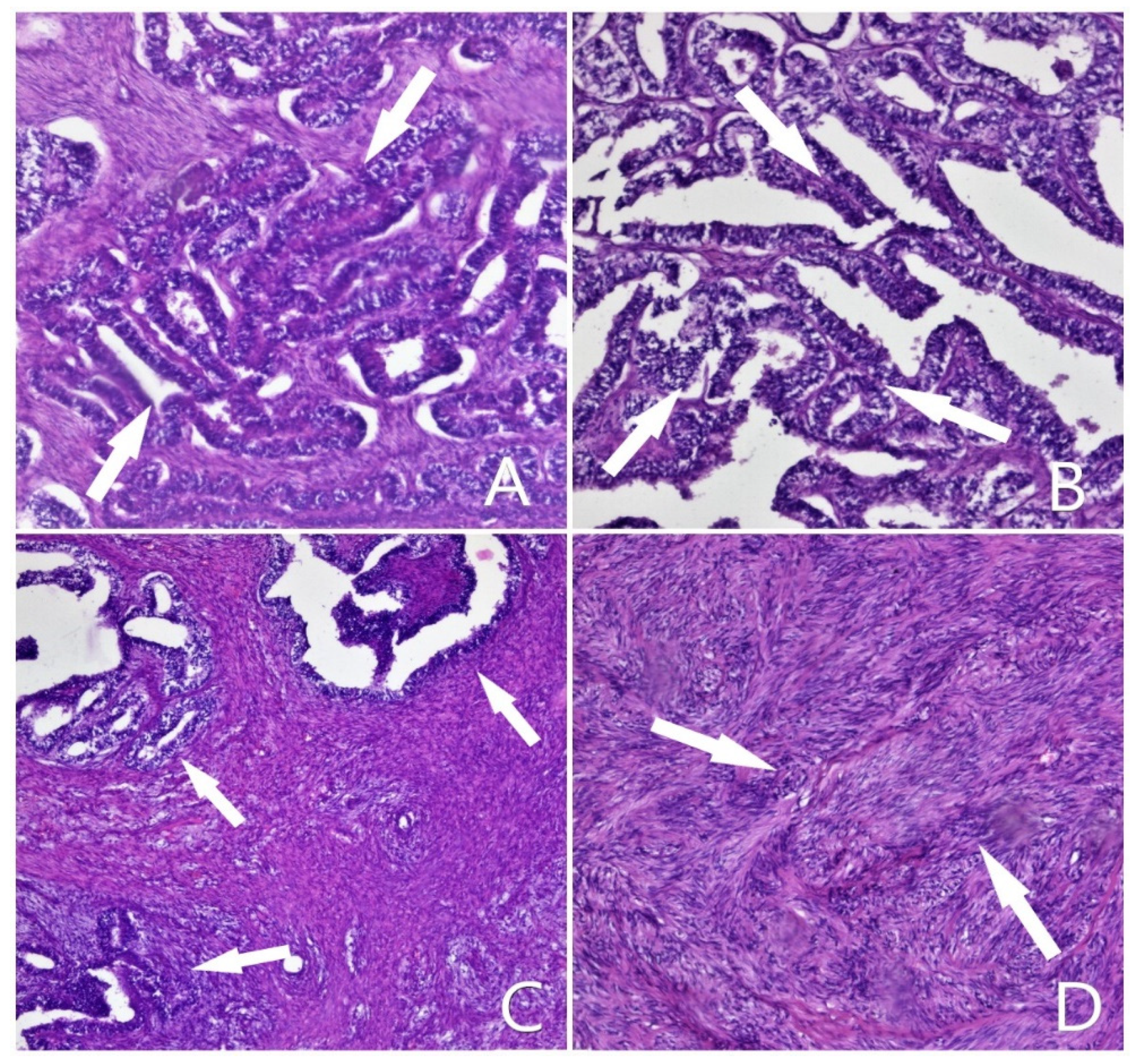 Diagnostics 12 00368 g001 550