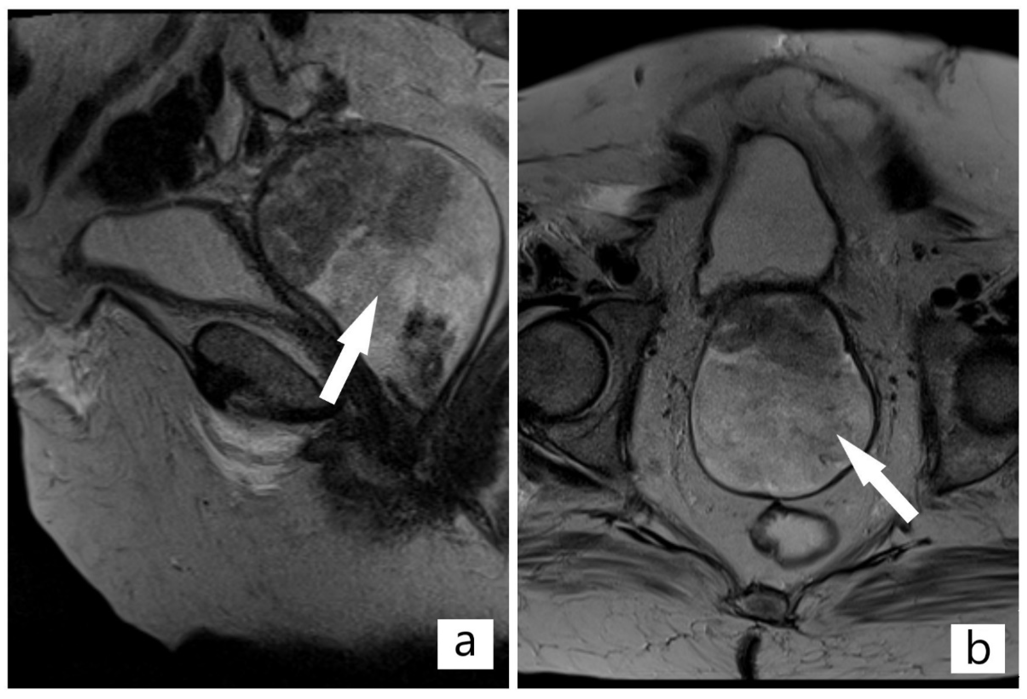 Diagnostics 12 00368 g002 550