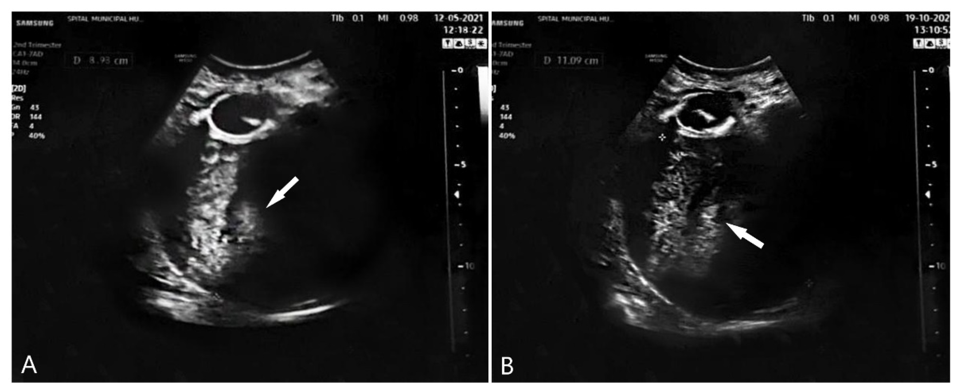 Diagnostics 12 00368 g004 550