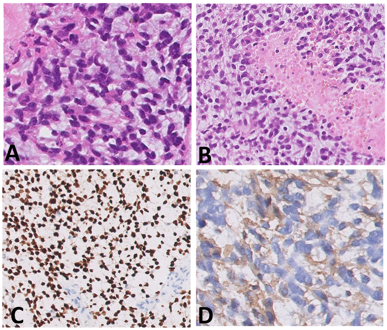 Diagnostics 12 00372 g001a 550