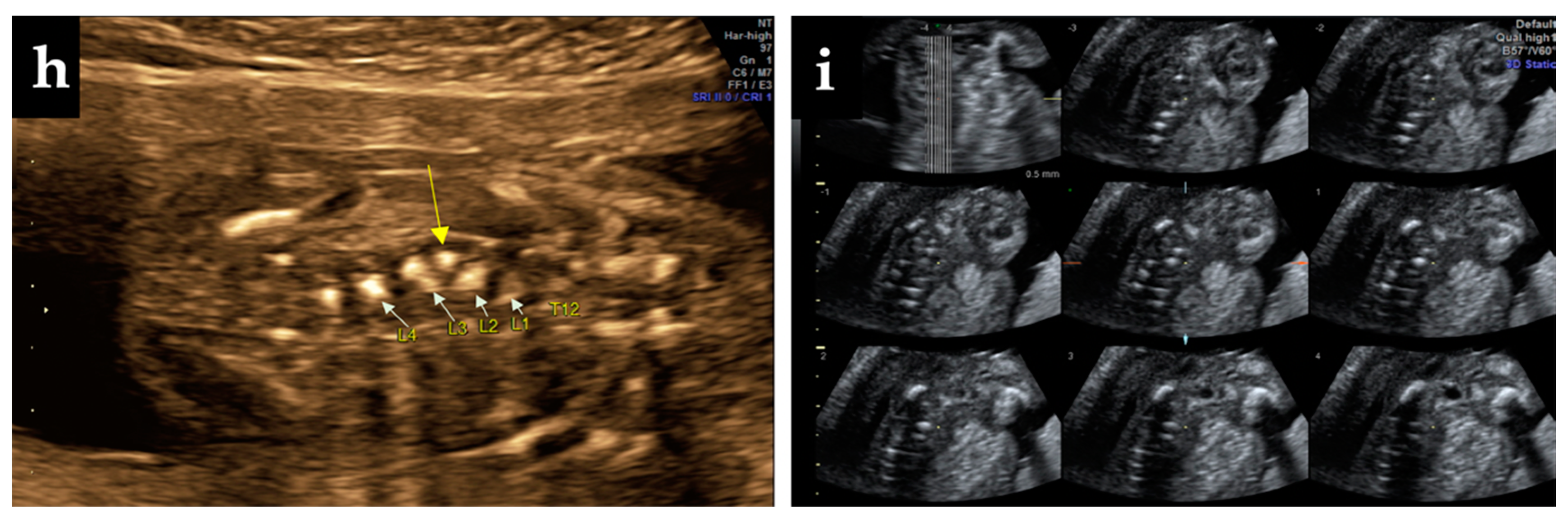 Diagnostics 12 00373 g001b