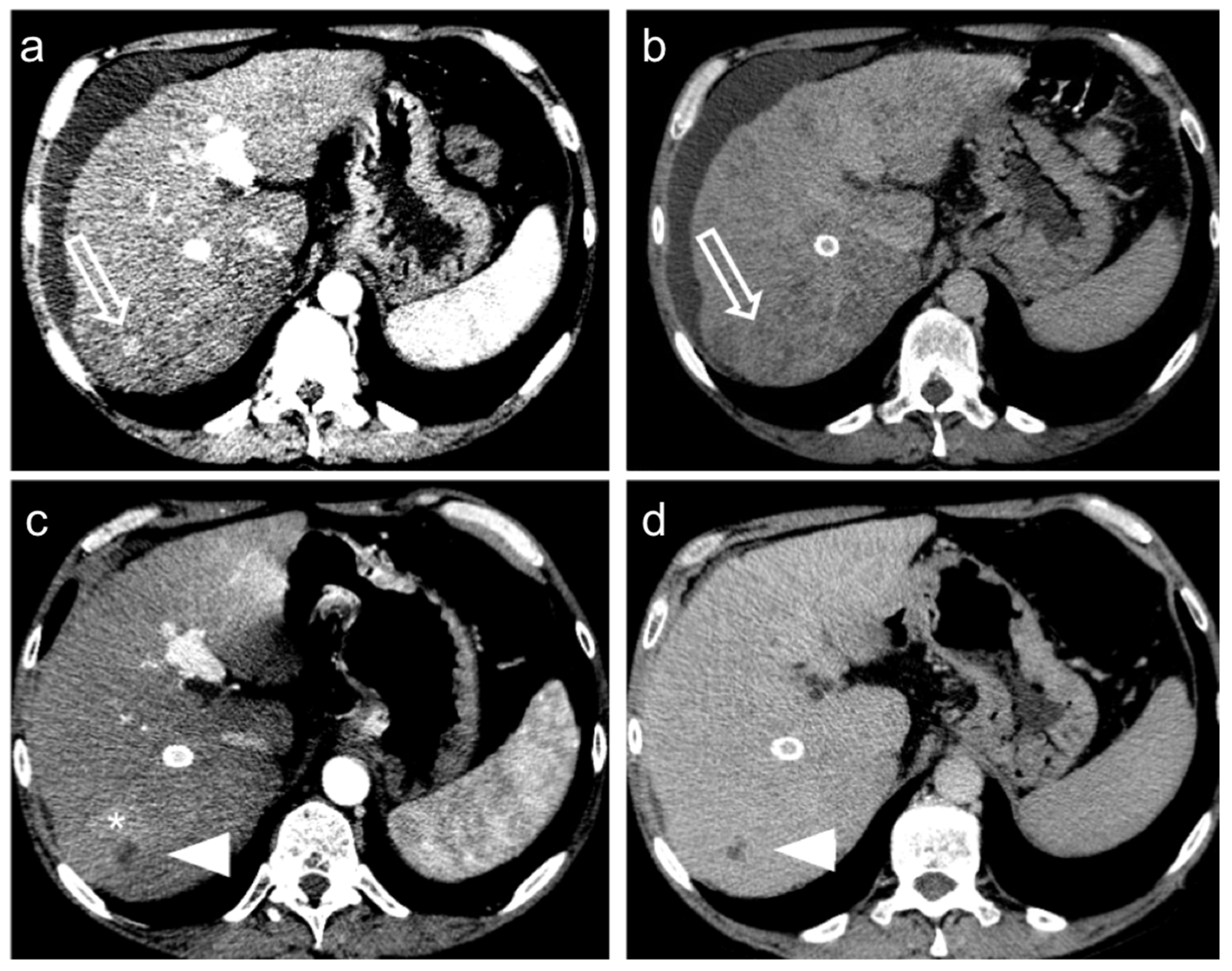 Diagnostics 12 00374 g004