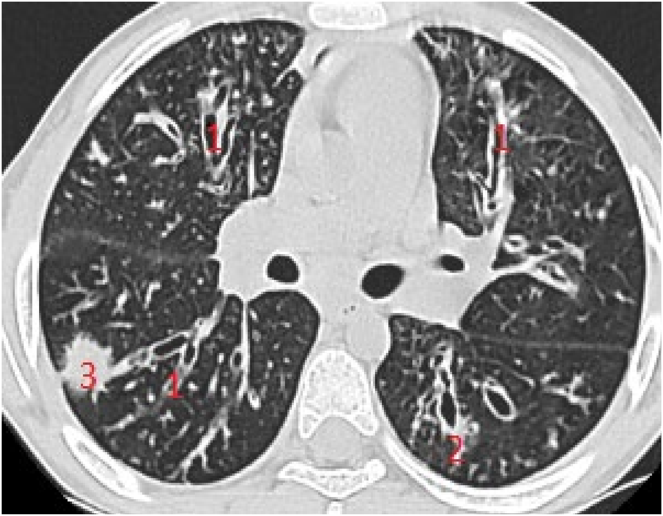 Diagnostics 12 00376 g004