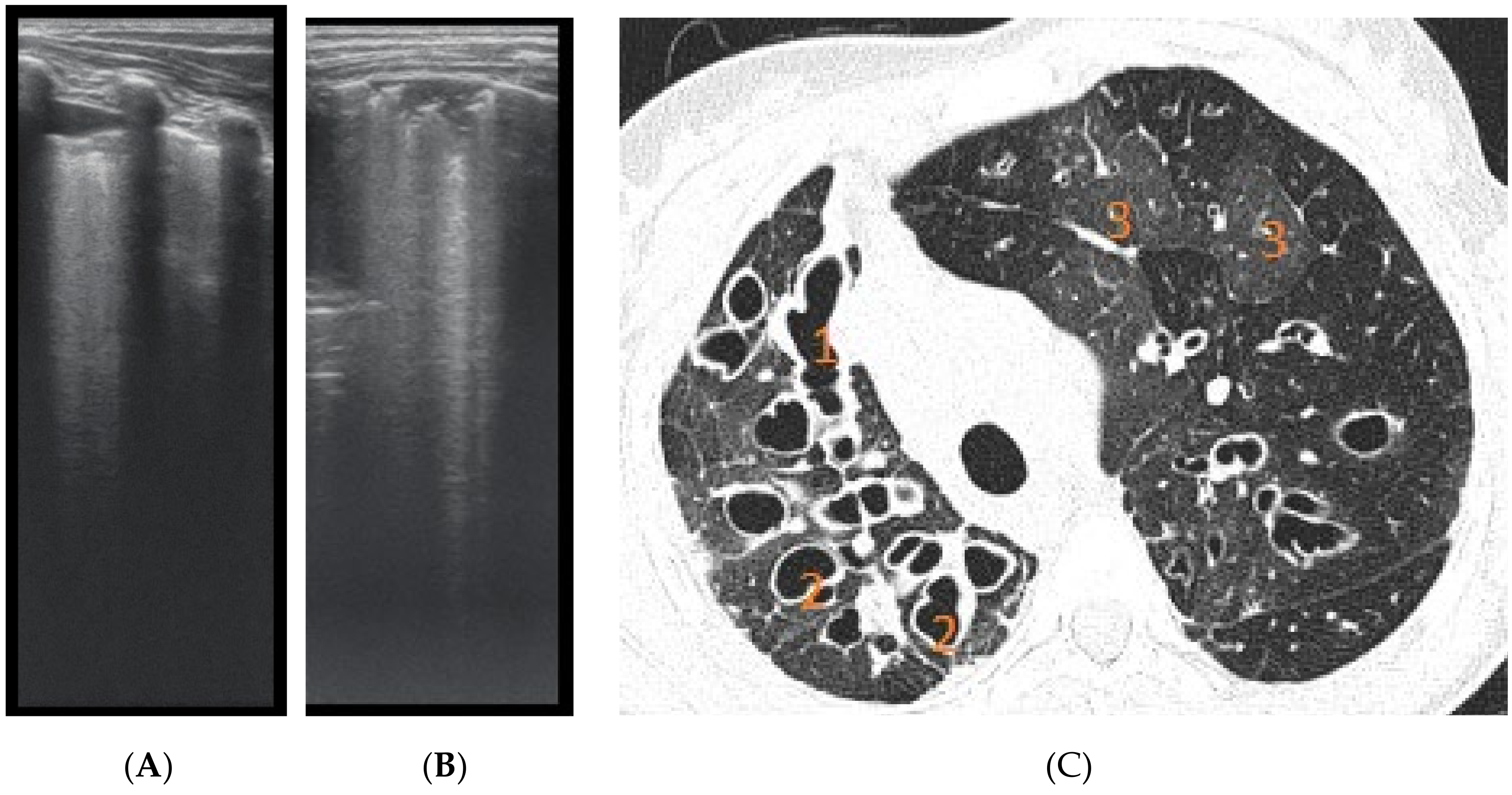 Diagnostics 12 00376 g007