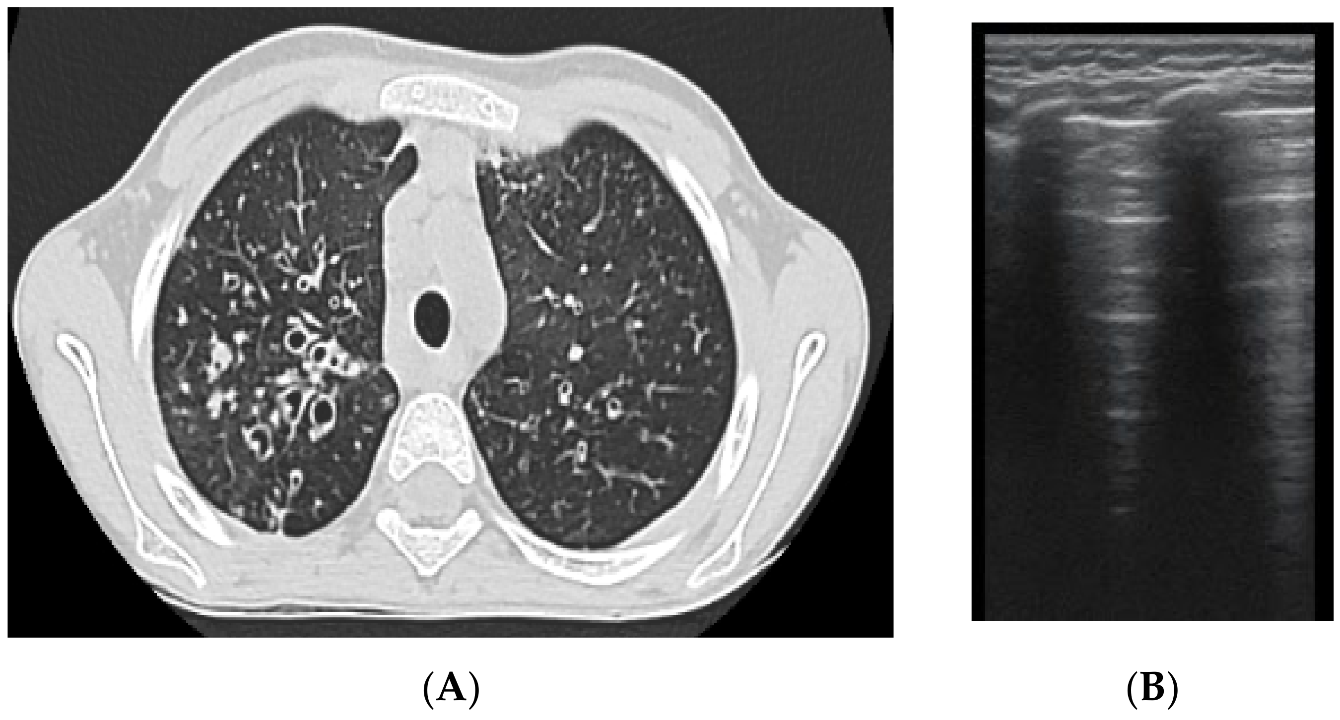 Diagnostics 12 00376 g008