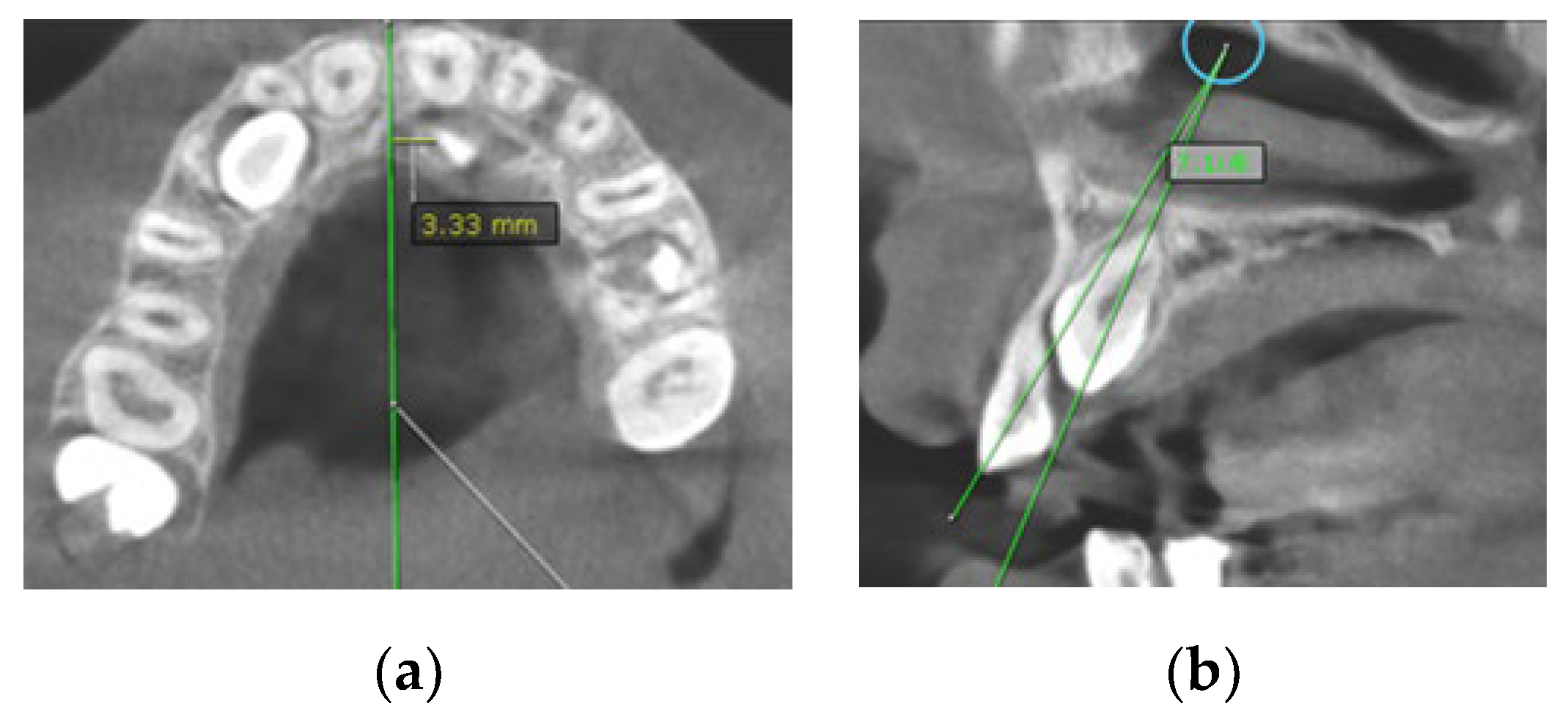 Diagnostics 12 00380 g002 550