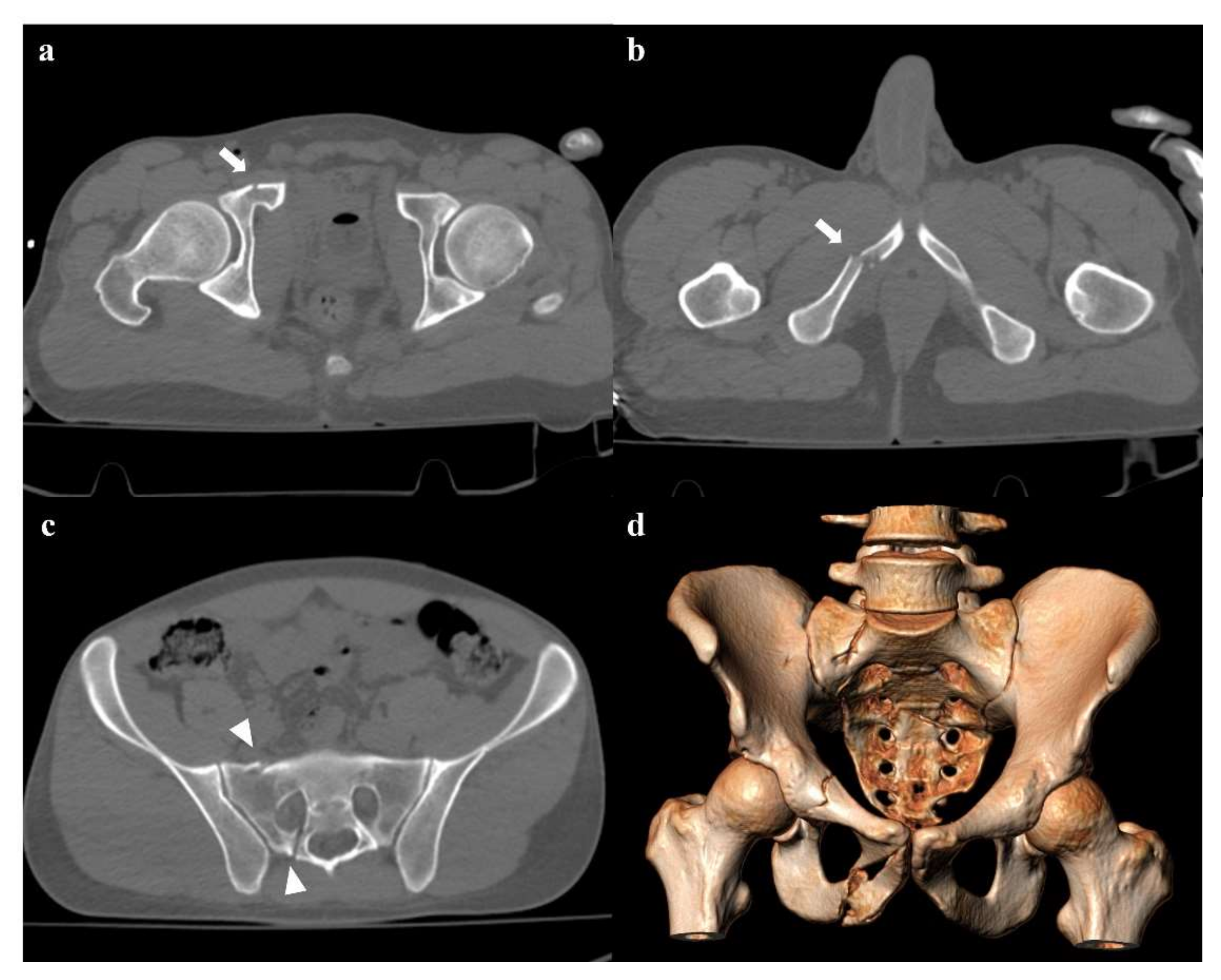 Pelvis, Radiology Reference Article