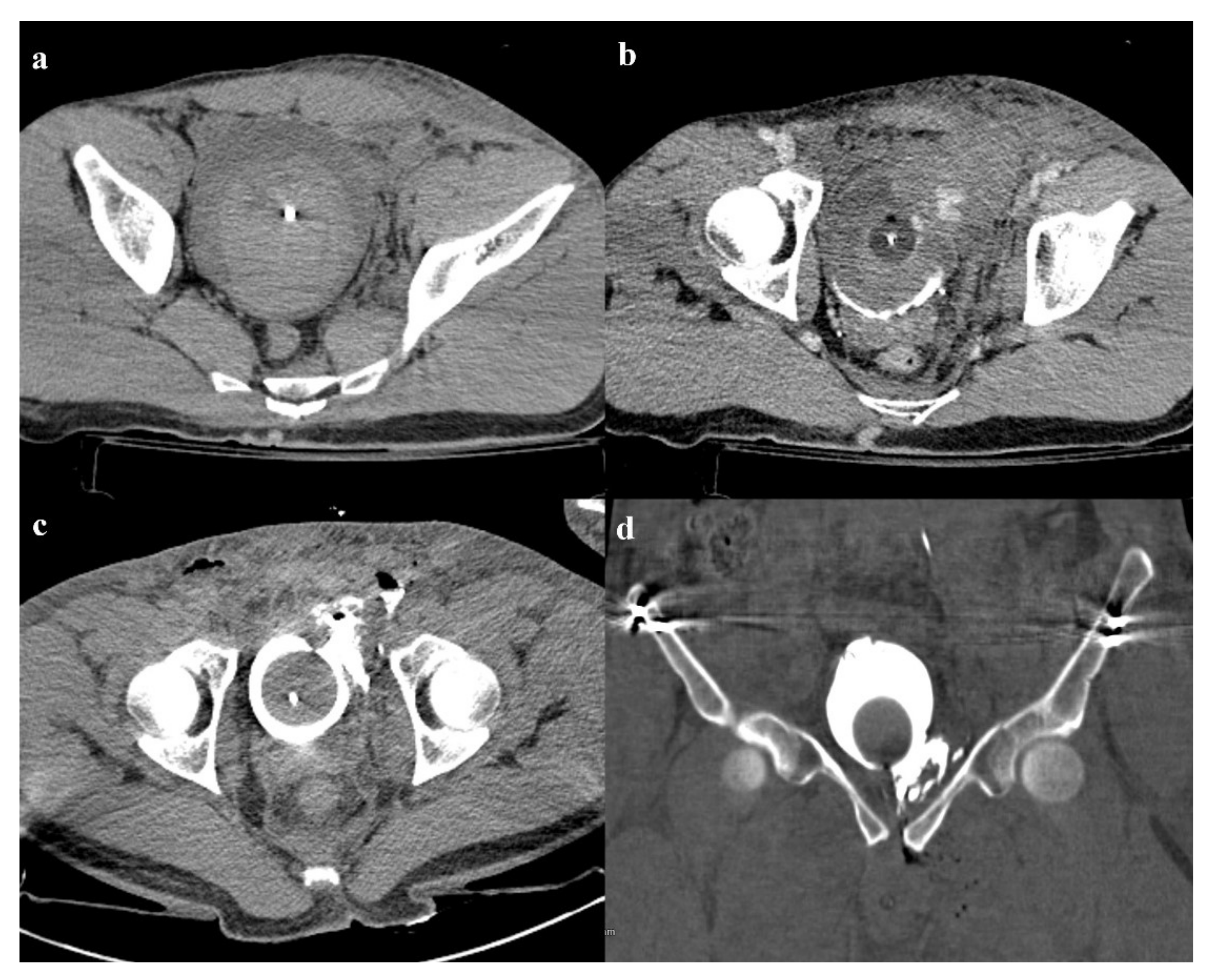 Diagnostics 12 00384 g012