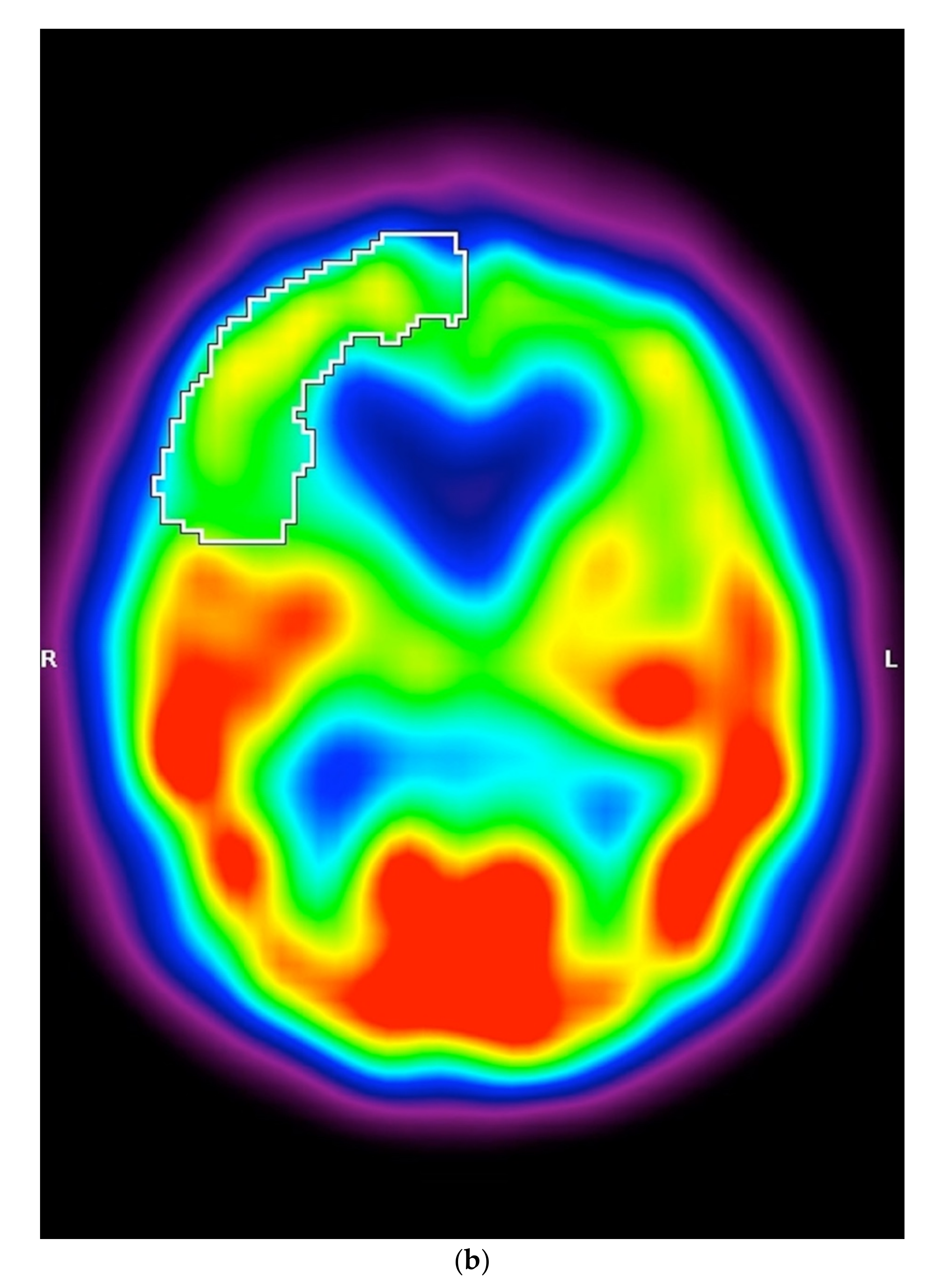 Diagnostics 12 00385 g002b