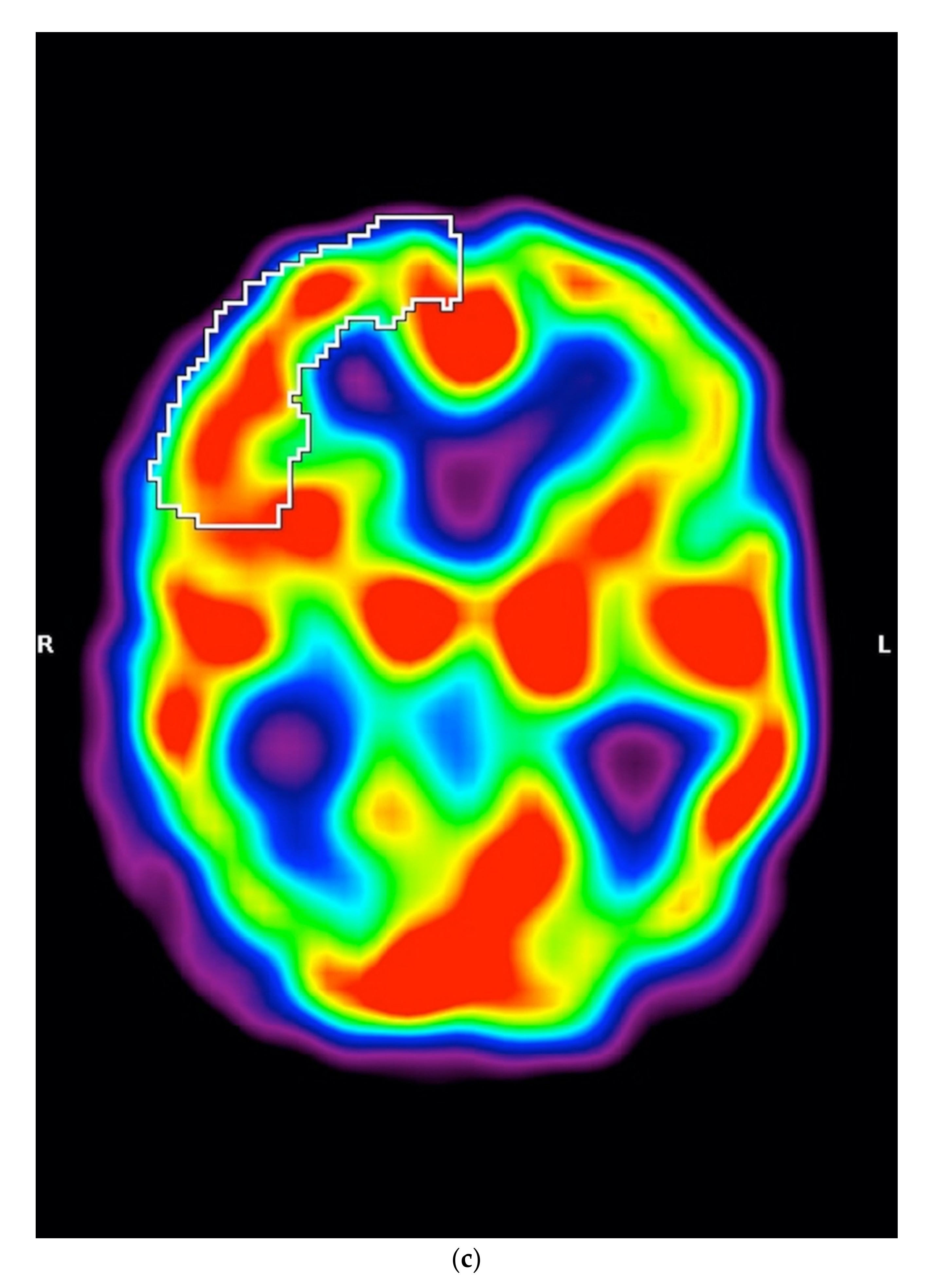 Diagnostics 12 00385 g002c