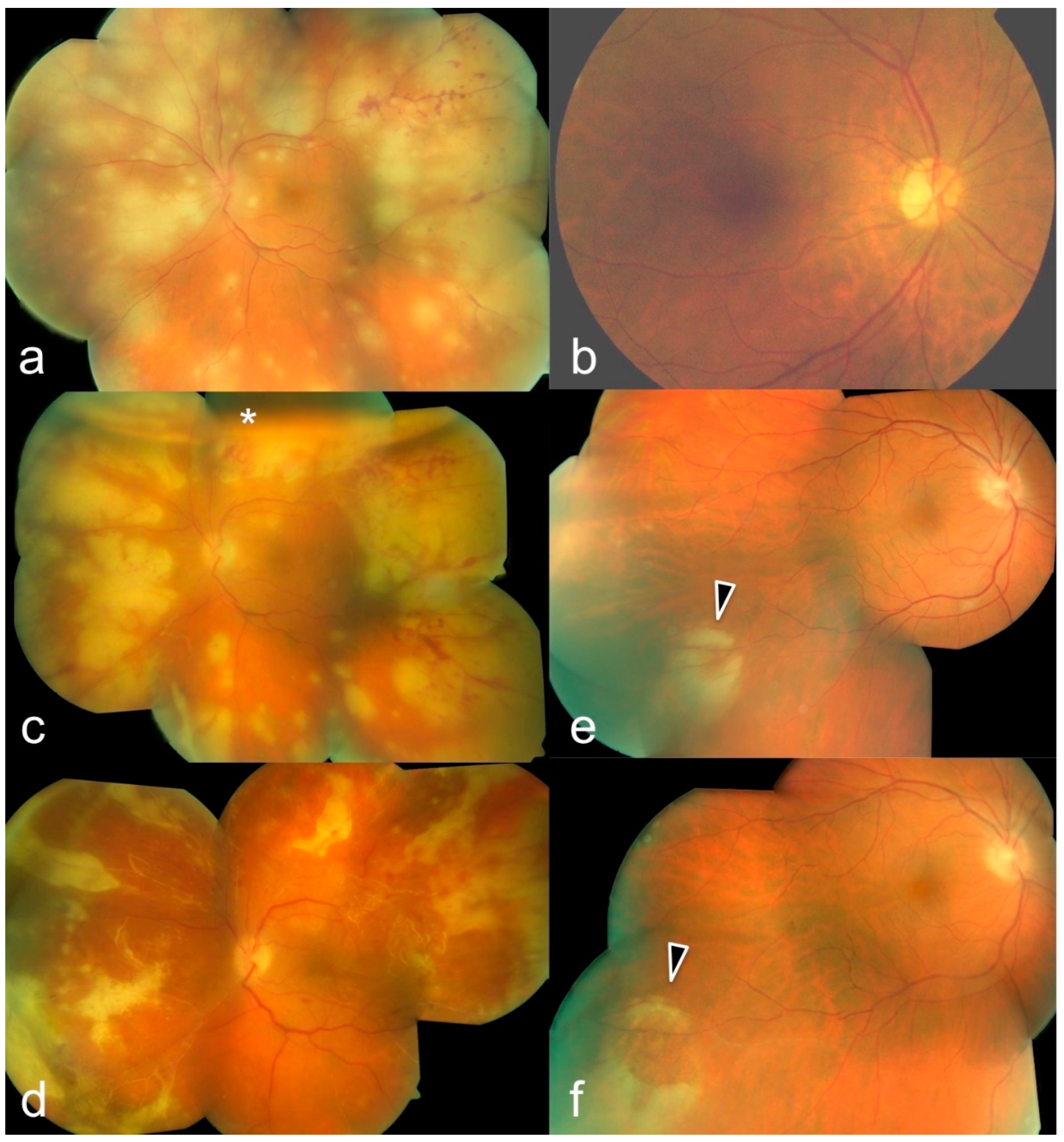 Diagnostics 12 00386 g002 Diagnostics 12 00386 g002