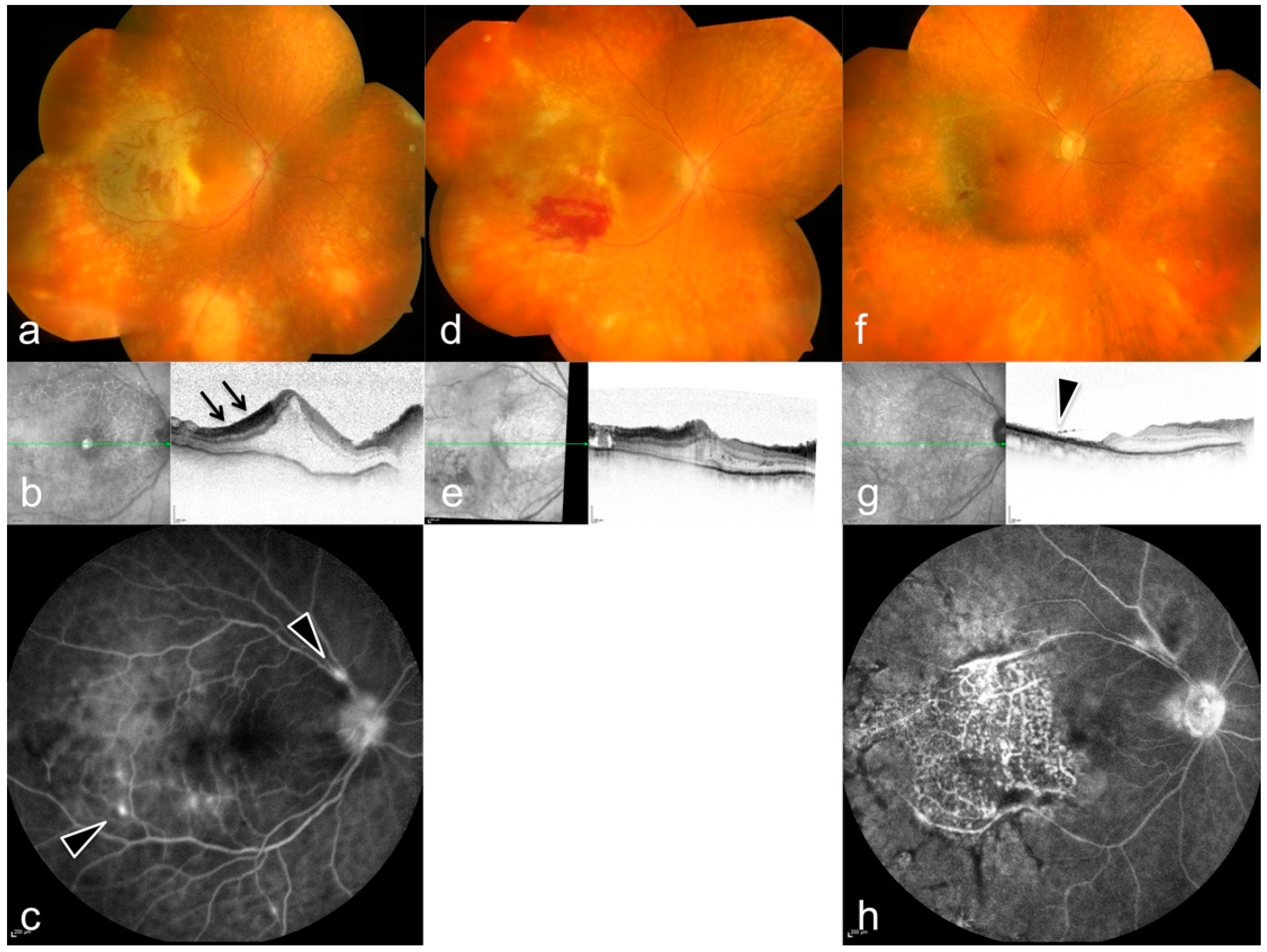 Diagnostics 12 00386 g003 Diagnostics 12 00386 g003