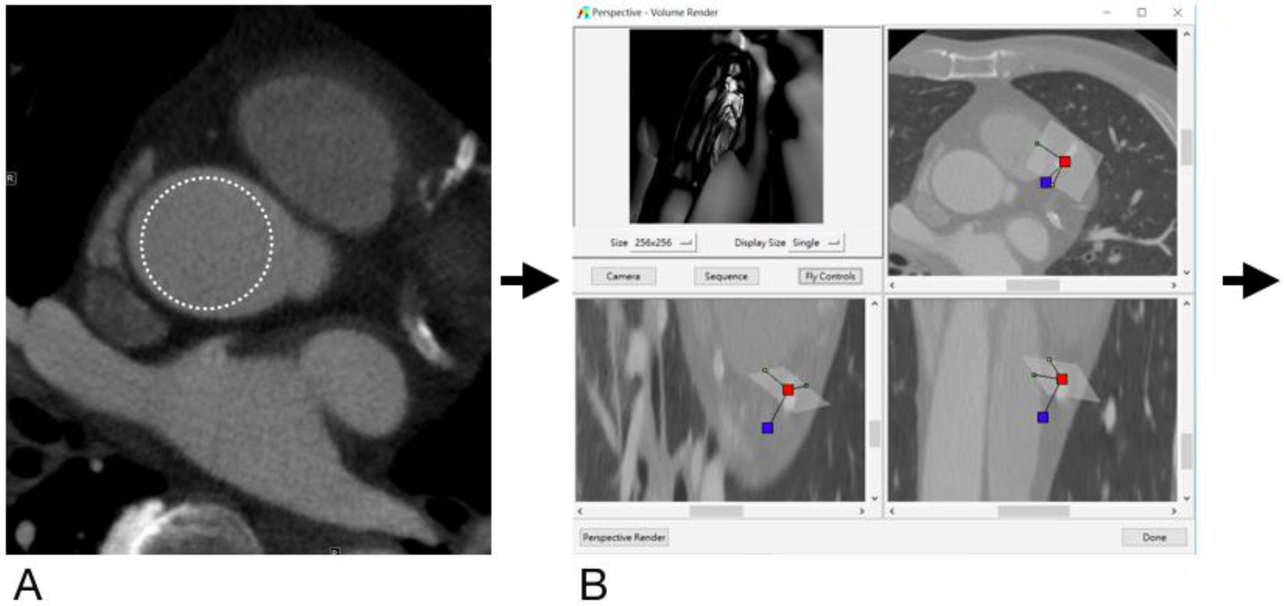 Diagnostics Free FullText Added Value of Computed Tomography