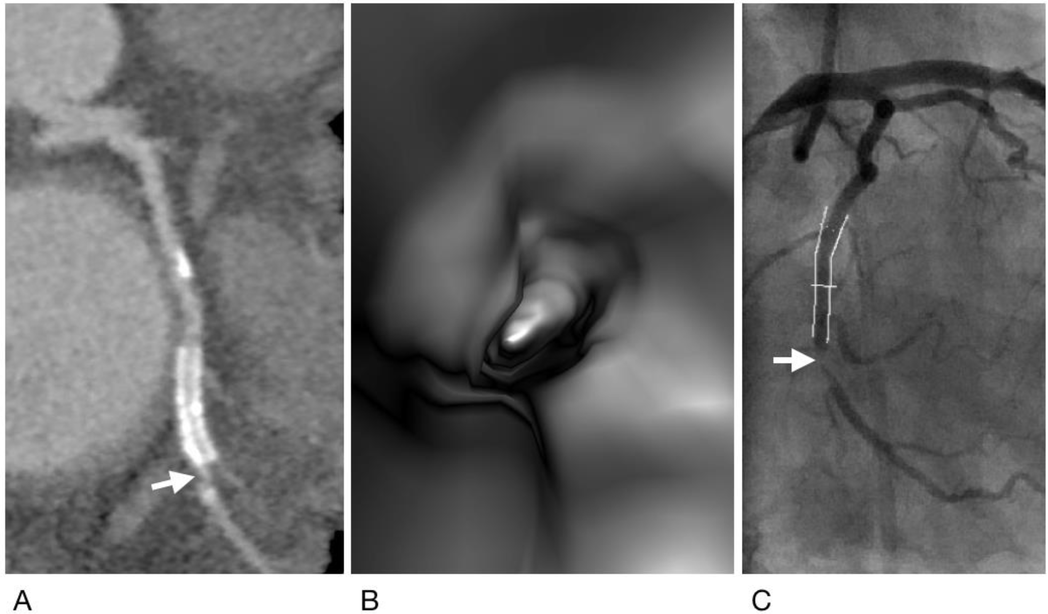 Diagnostics 12 00390 g003
