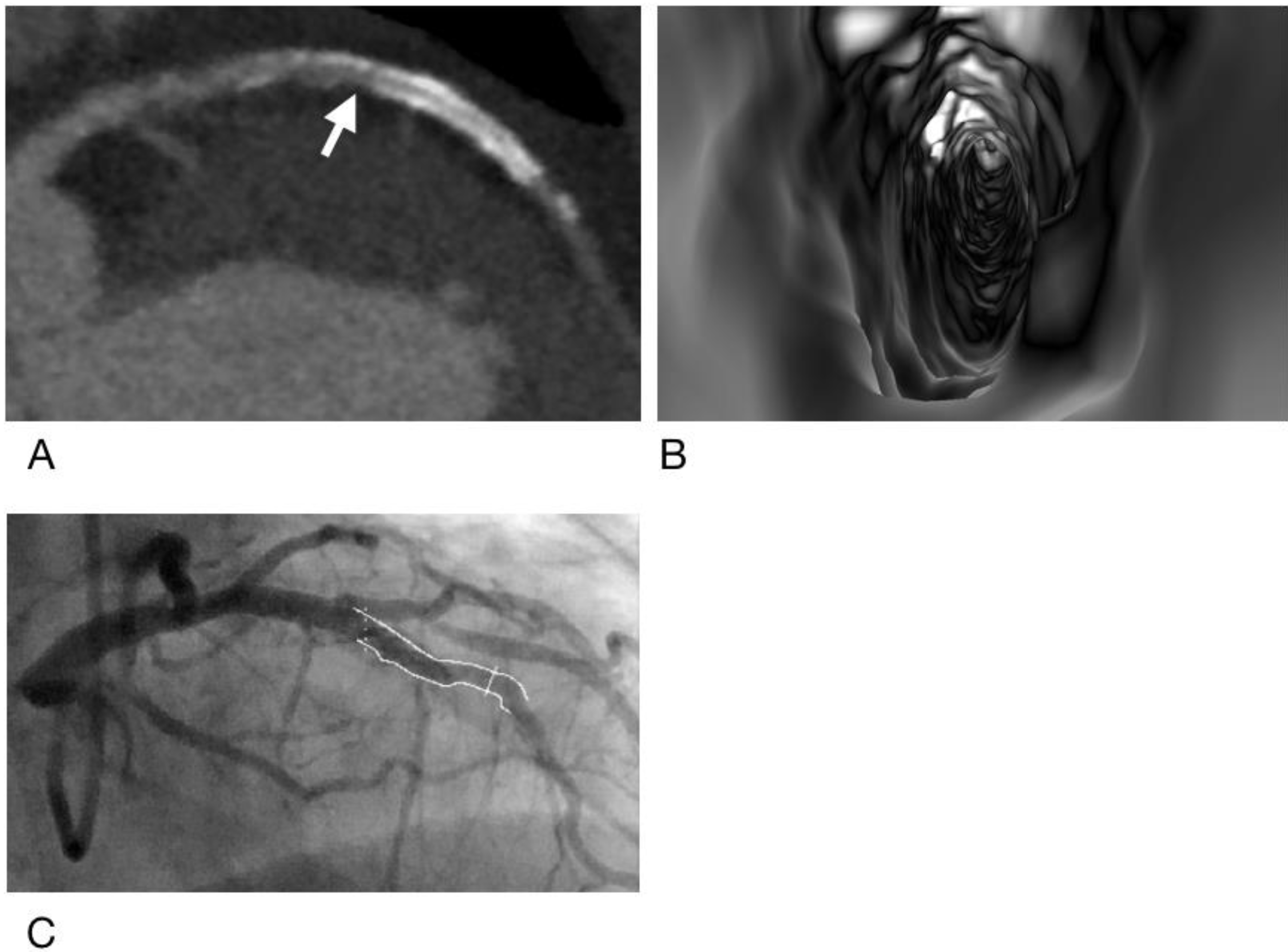 Diagnostics 12 00390 g004