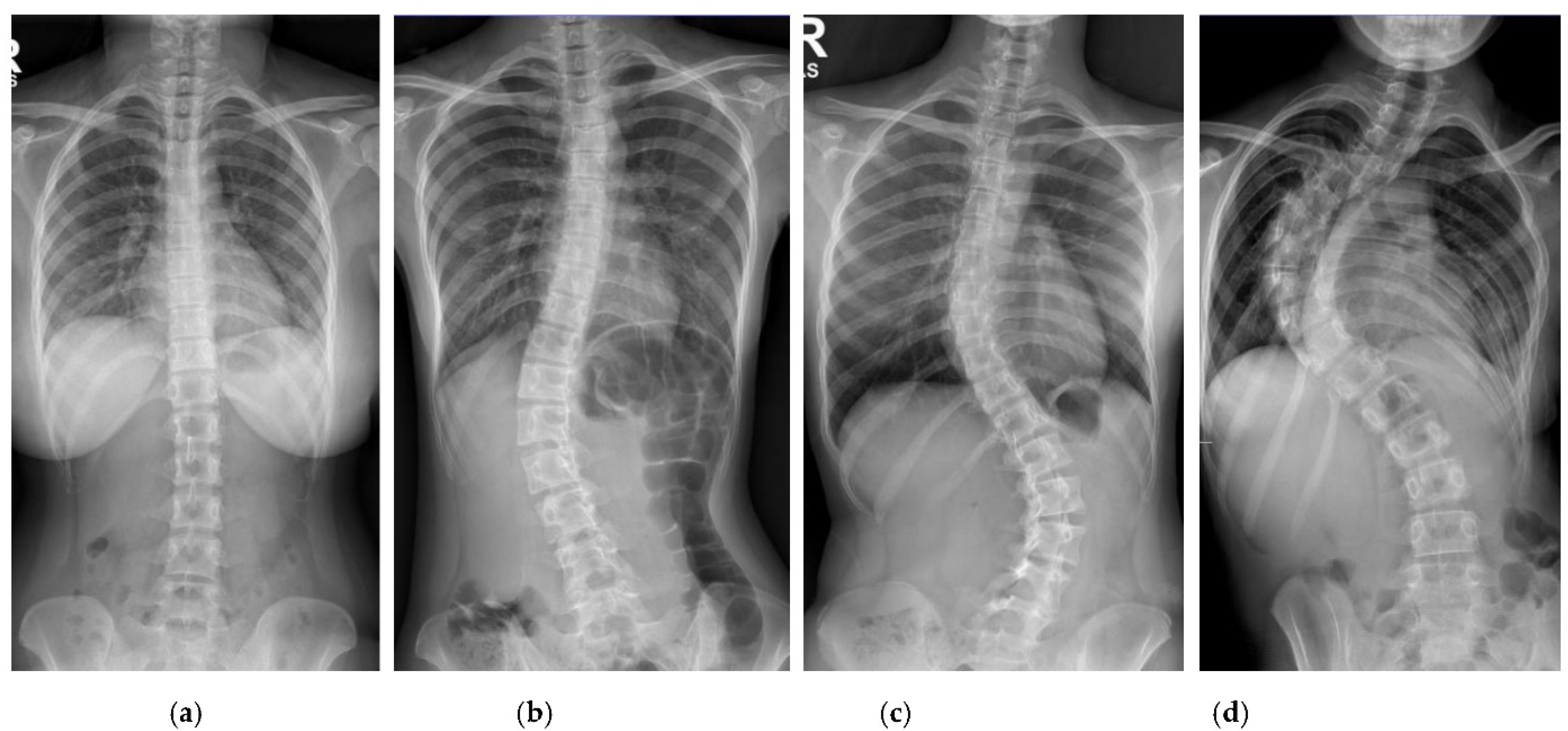 Diagnostics 12 00396 g002 550