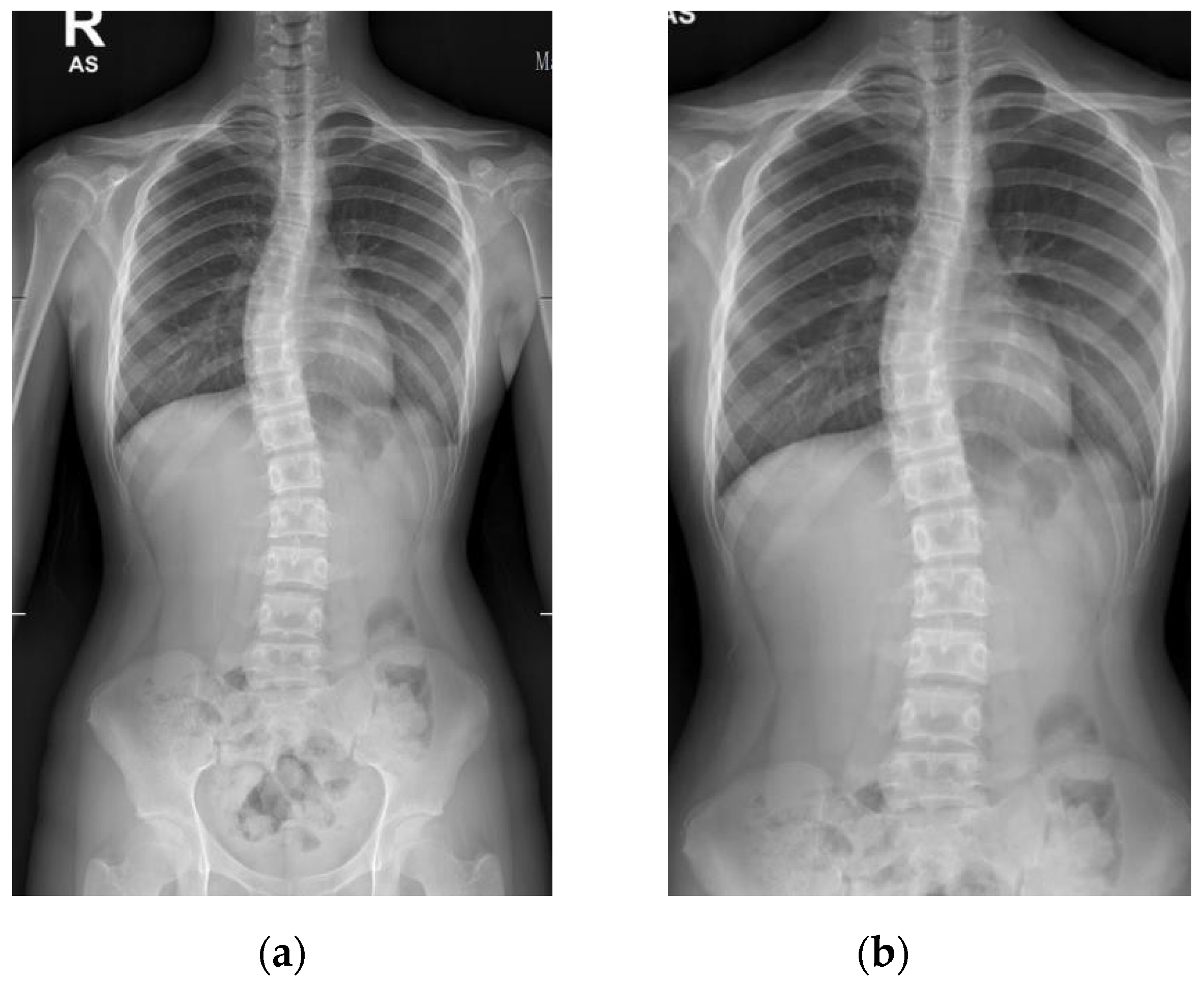 Diagnostics 12 00396 g004 550