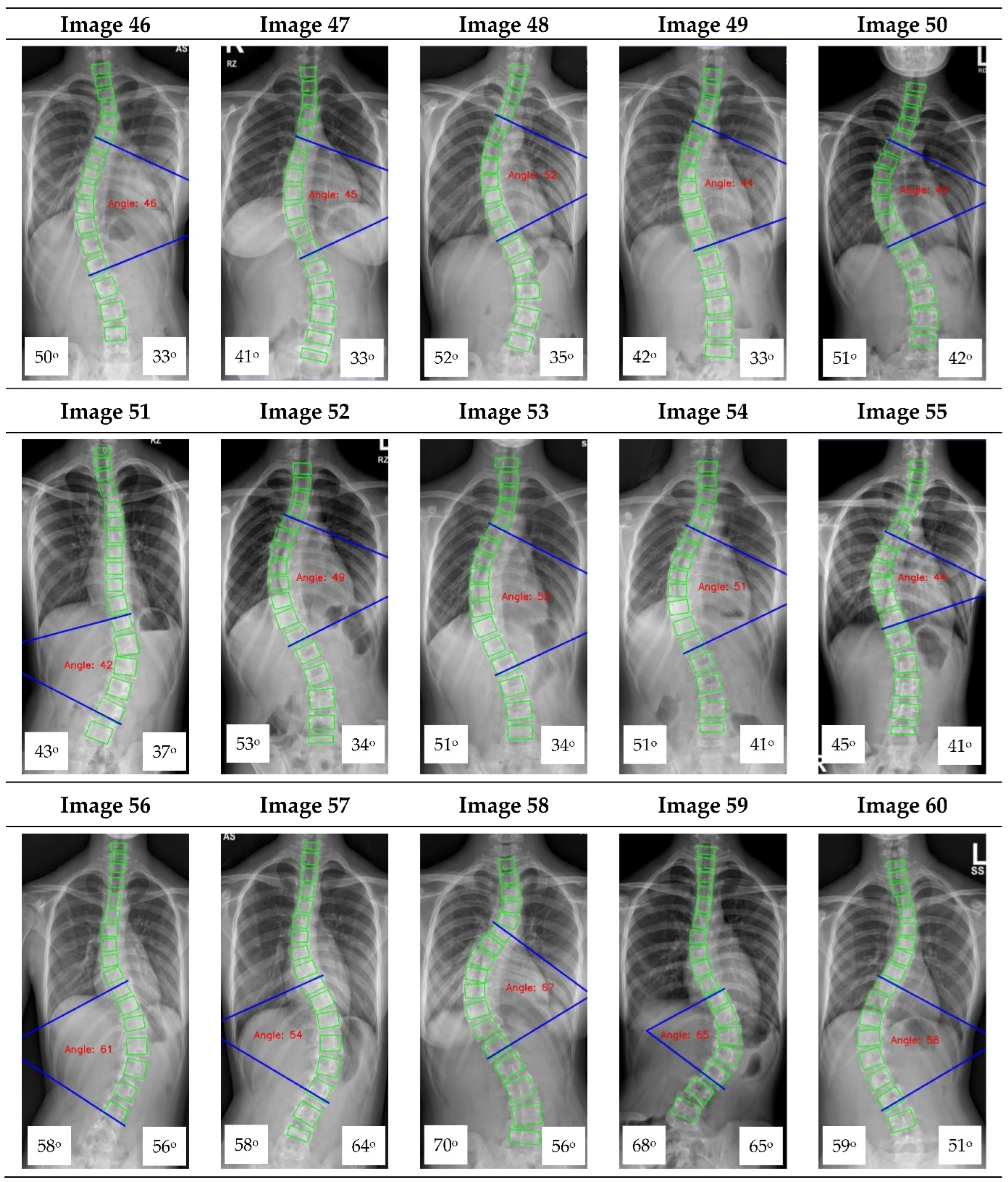 Diagnostics 12 00396 g0a1d 550