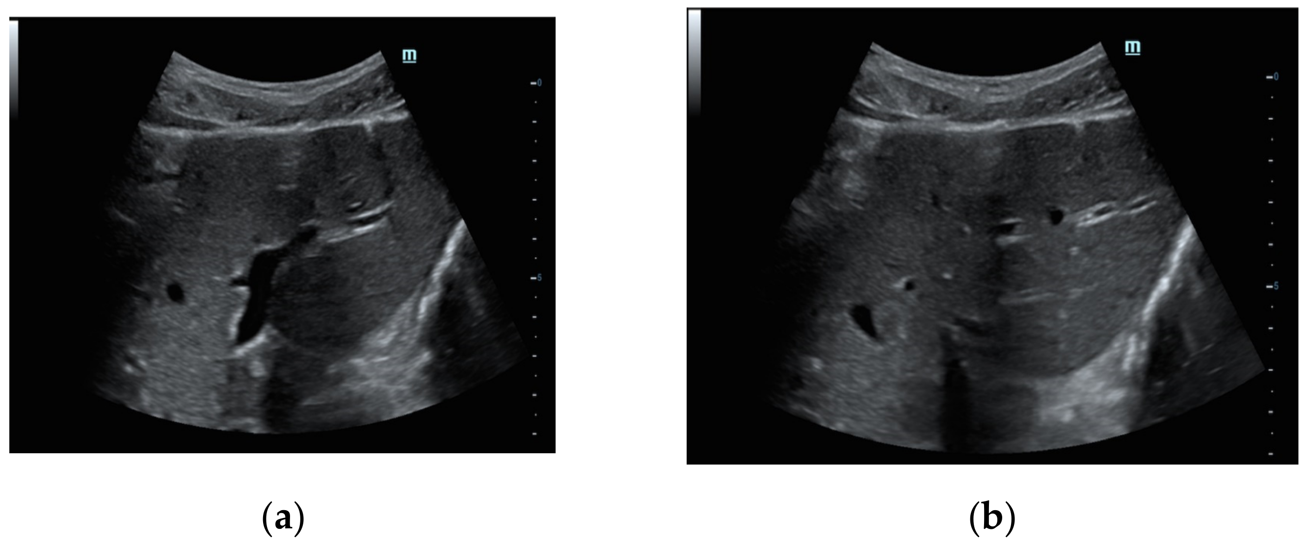 Diagnostics 12 00401 g002 550