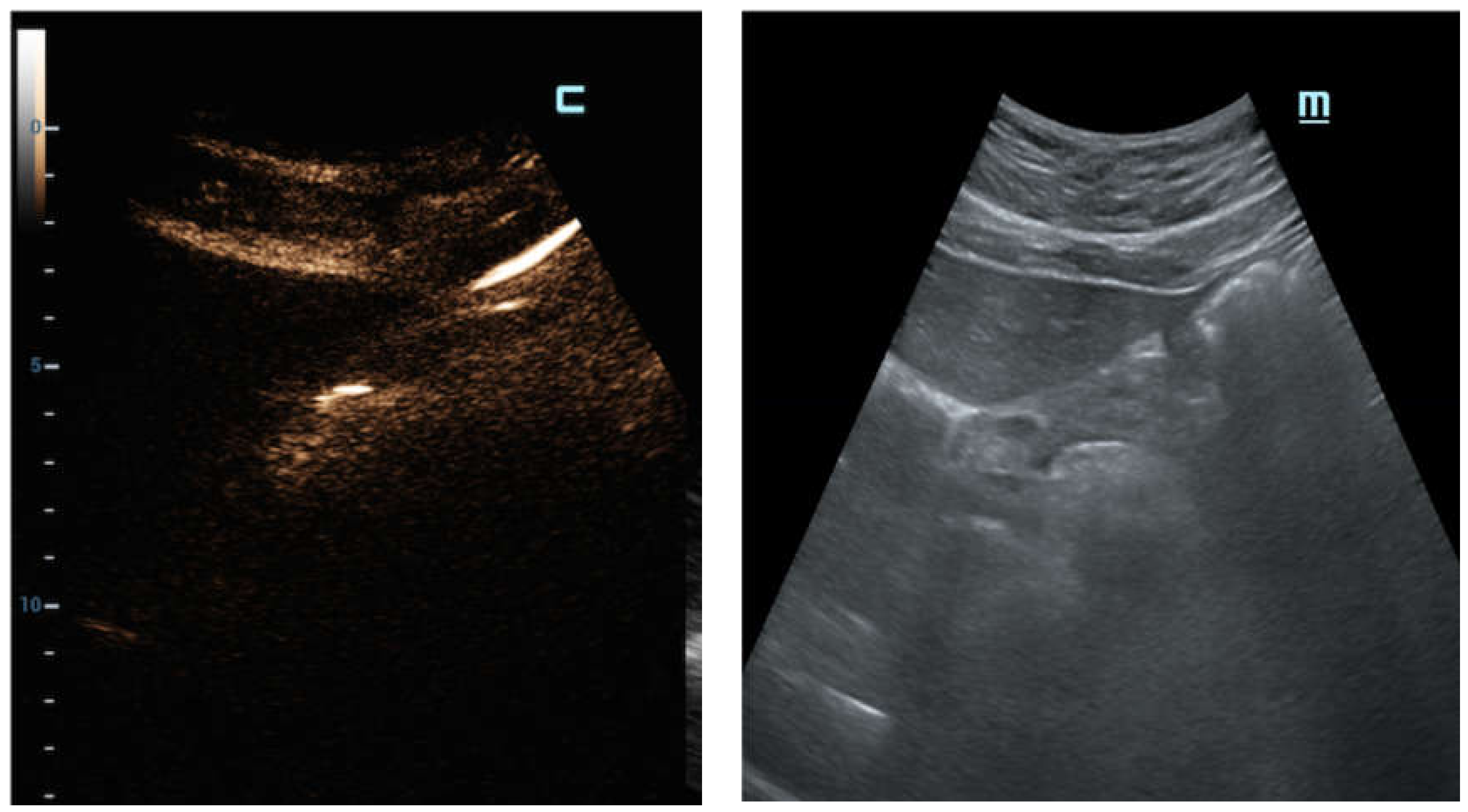 Diagnostics 12 00401 g003 550