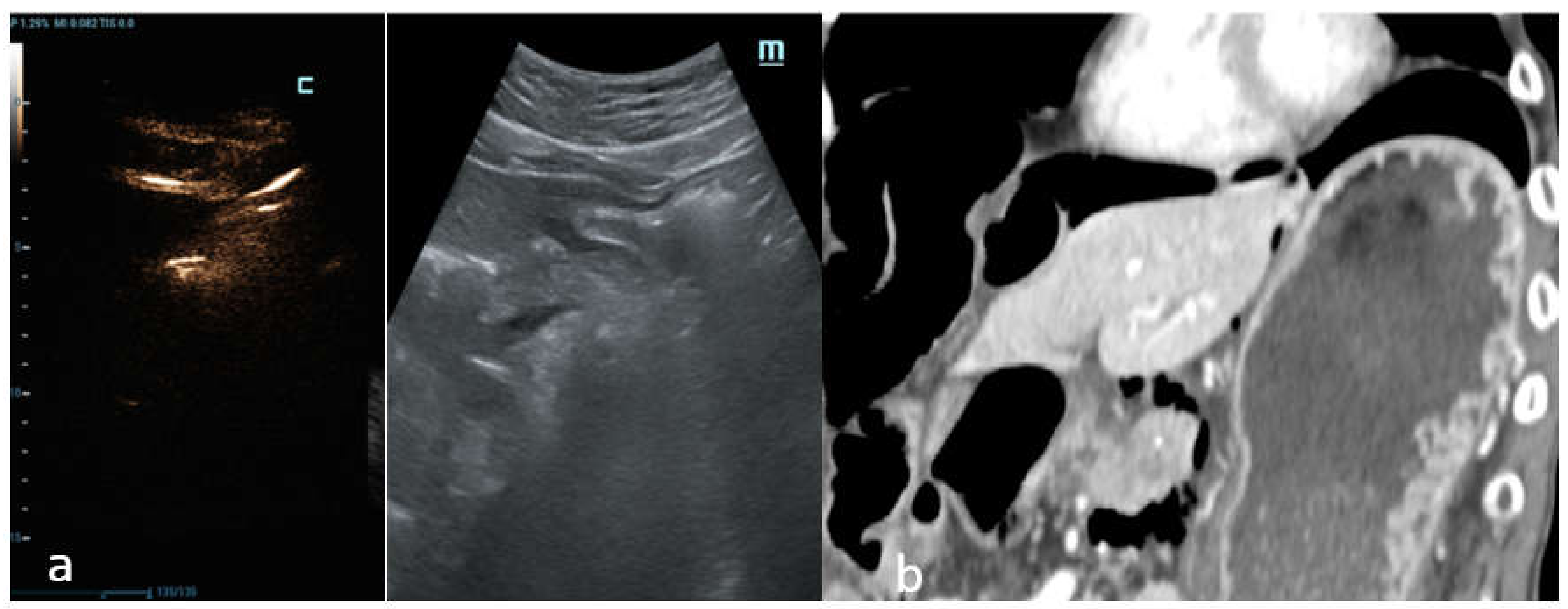 Diagnostics 12 00401 g004 550