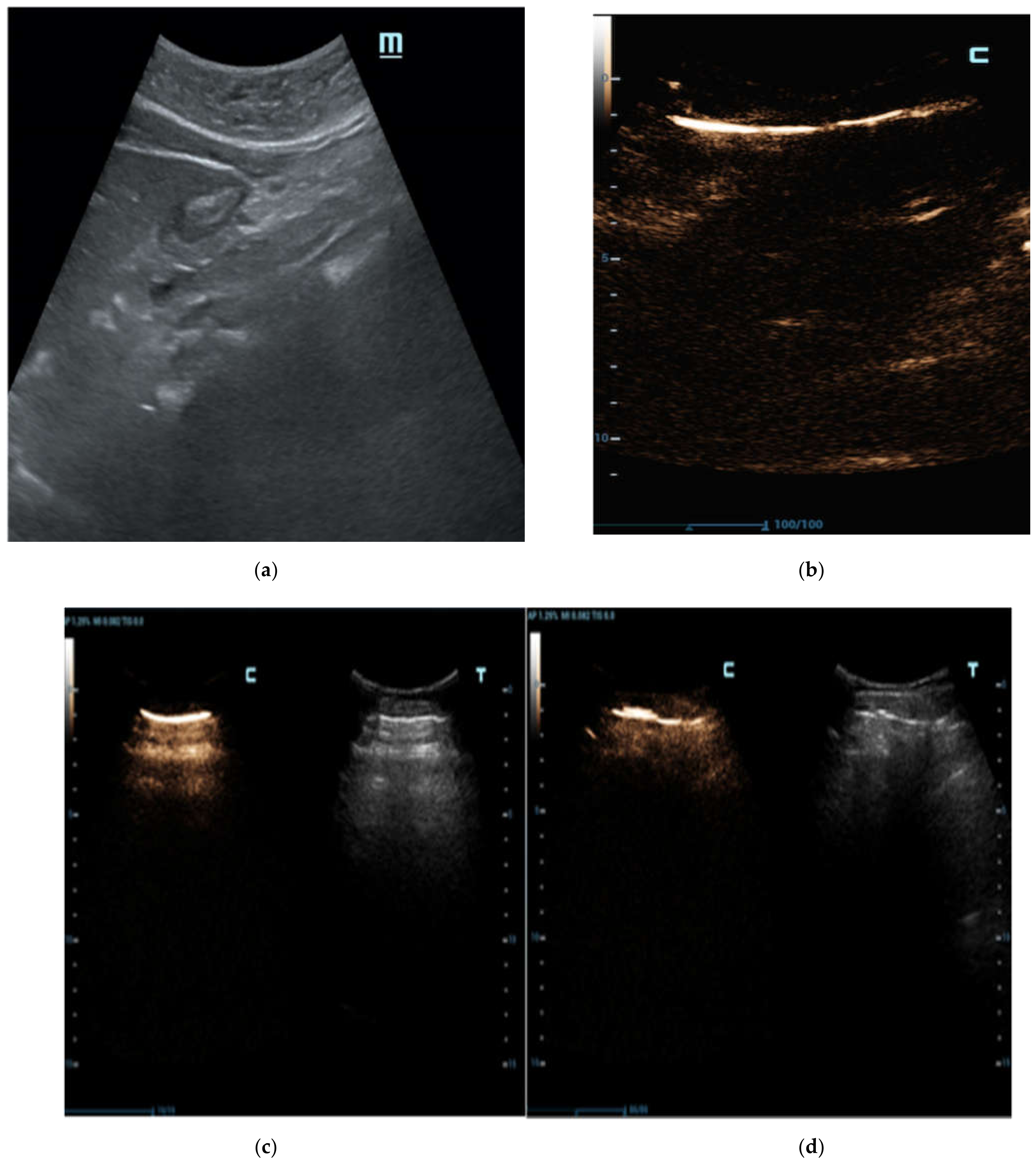 Diagnostics 12 00401 g005 550