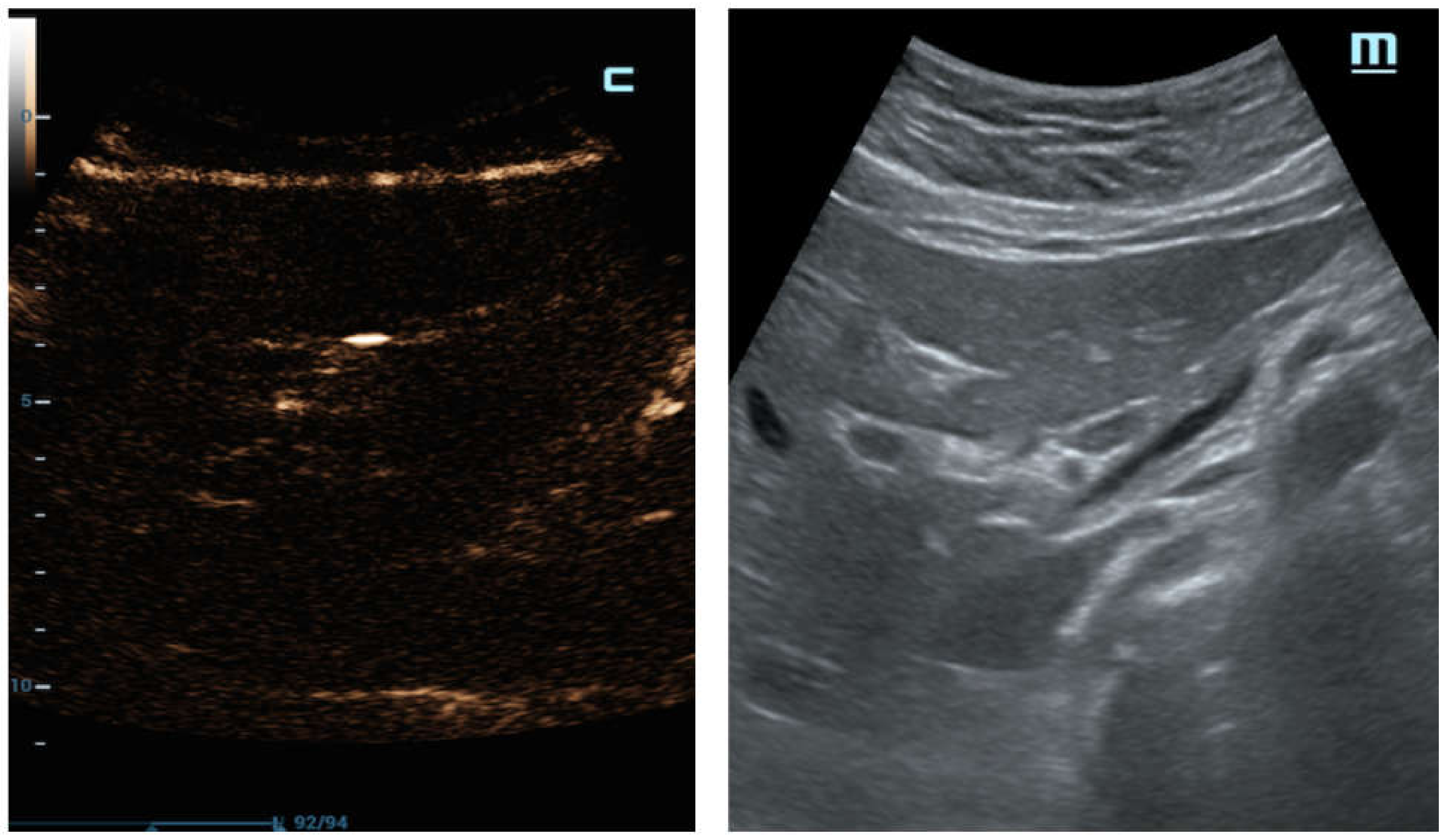Diagnostics 12 00401 g007 550