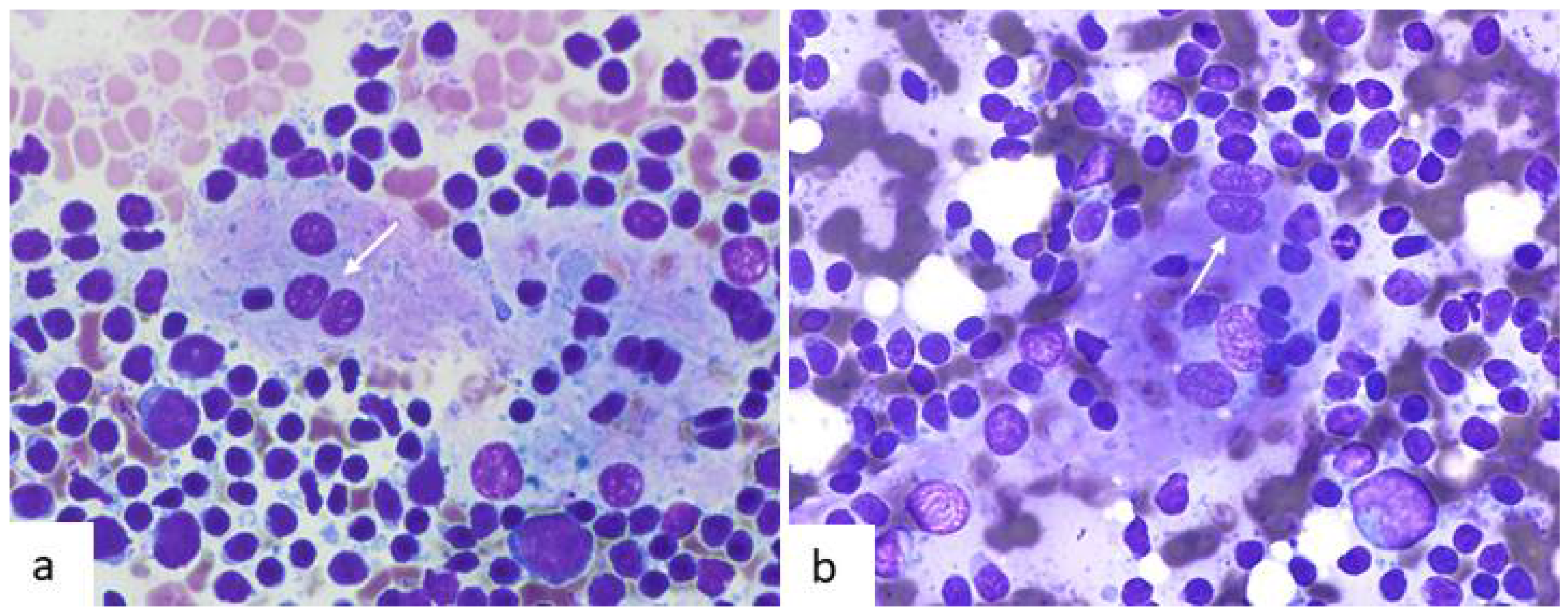 Diagnostics Free FullText A Cytological Review of Follicular