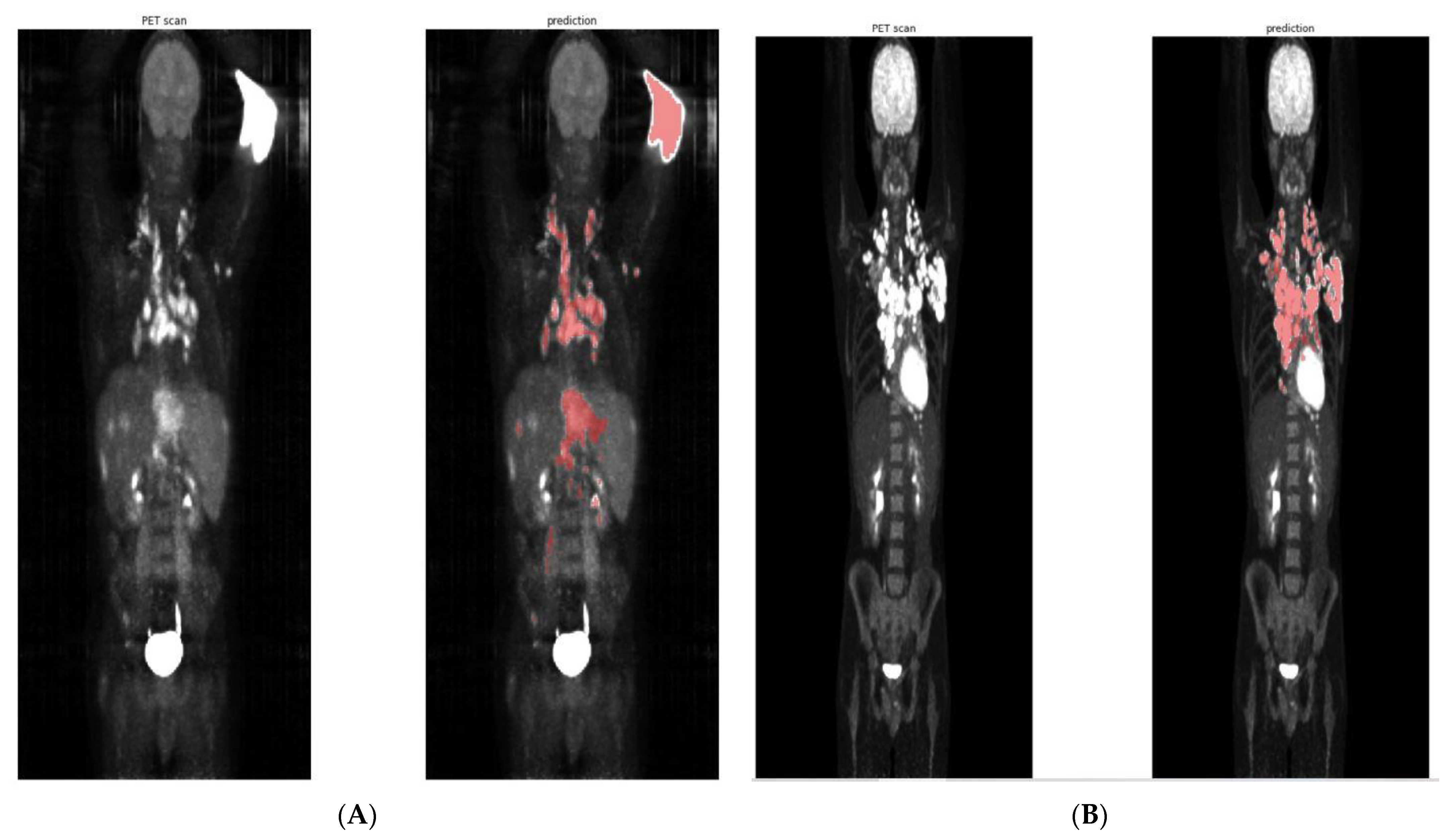 Diagnostics 12 00417 g004