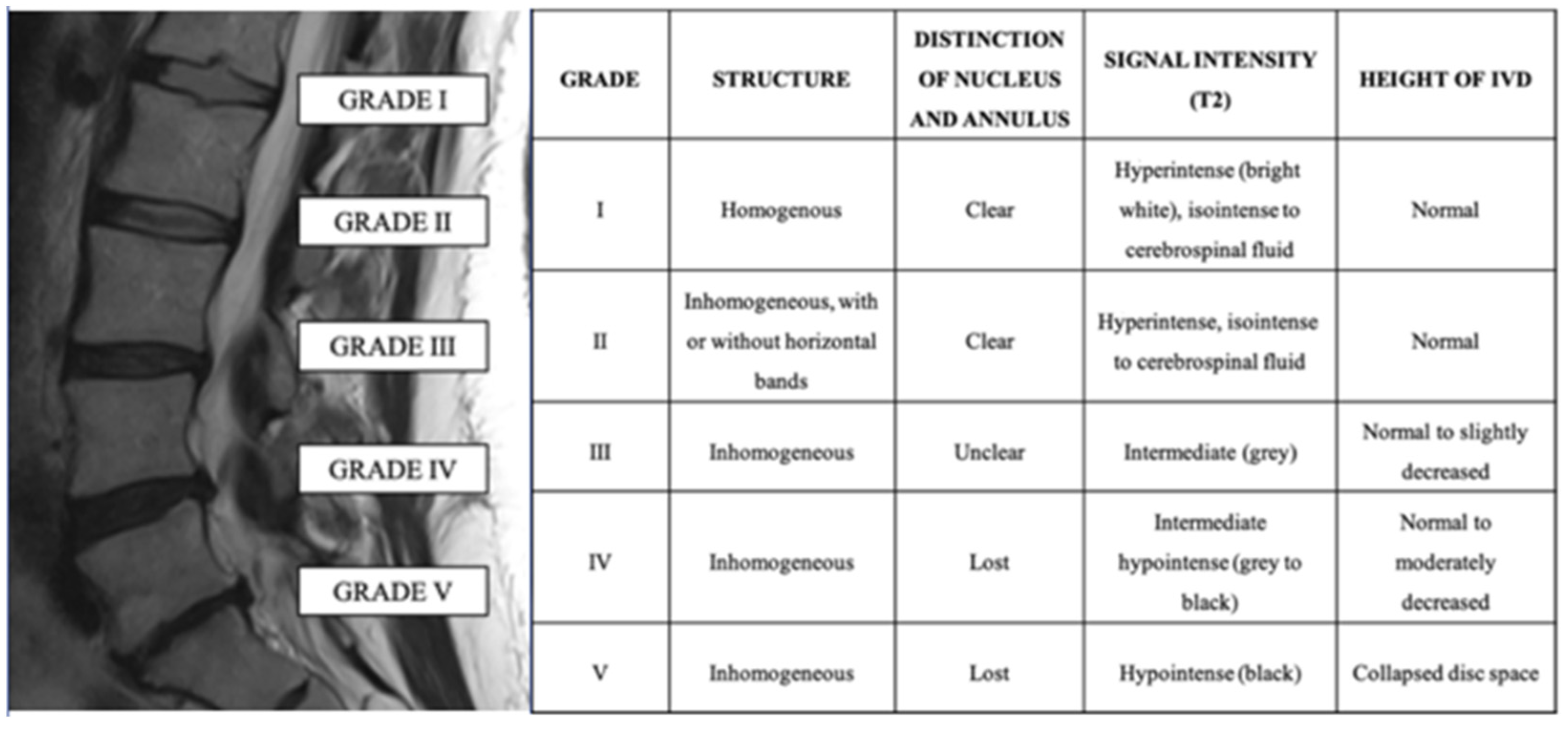 Amazon.com: Intervertebral Disk Diseases: Causes, Diagnosis
