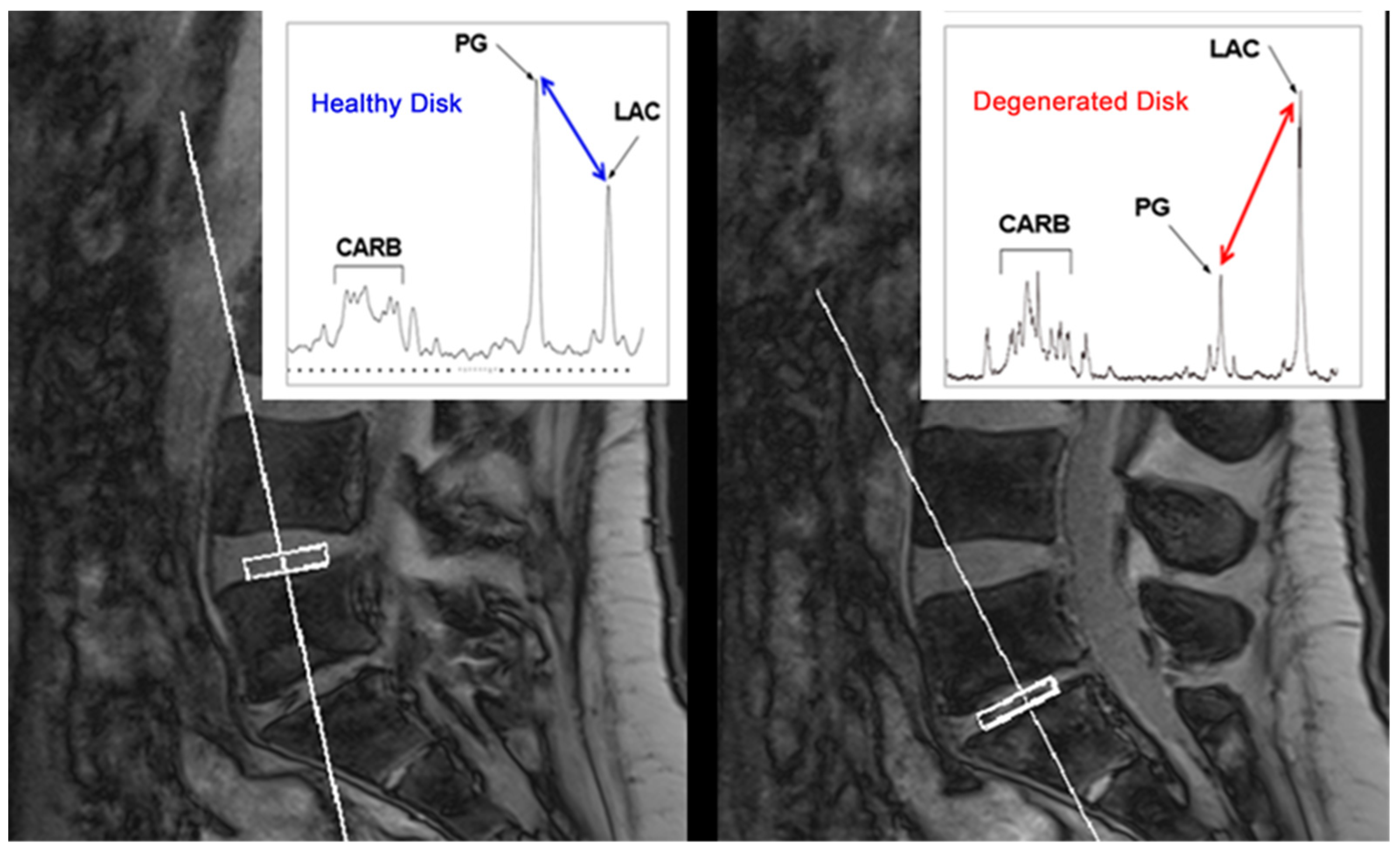 Novel Magnetic Resonance Imaging Tools for the Diagnosis of