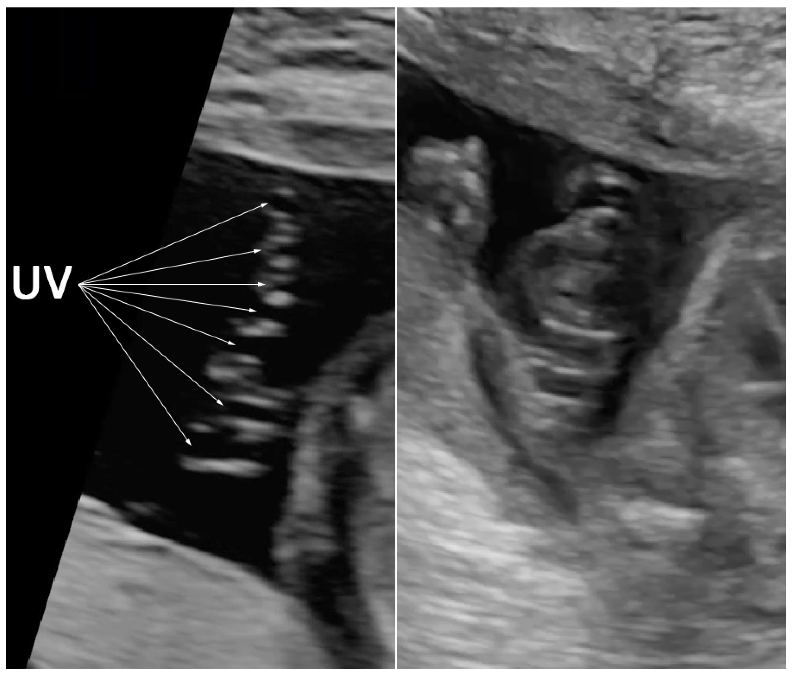 Diagnostics 12 00421 g002 Diagnostics 12 00421 g002