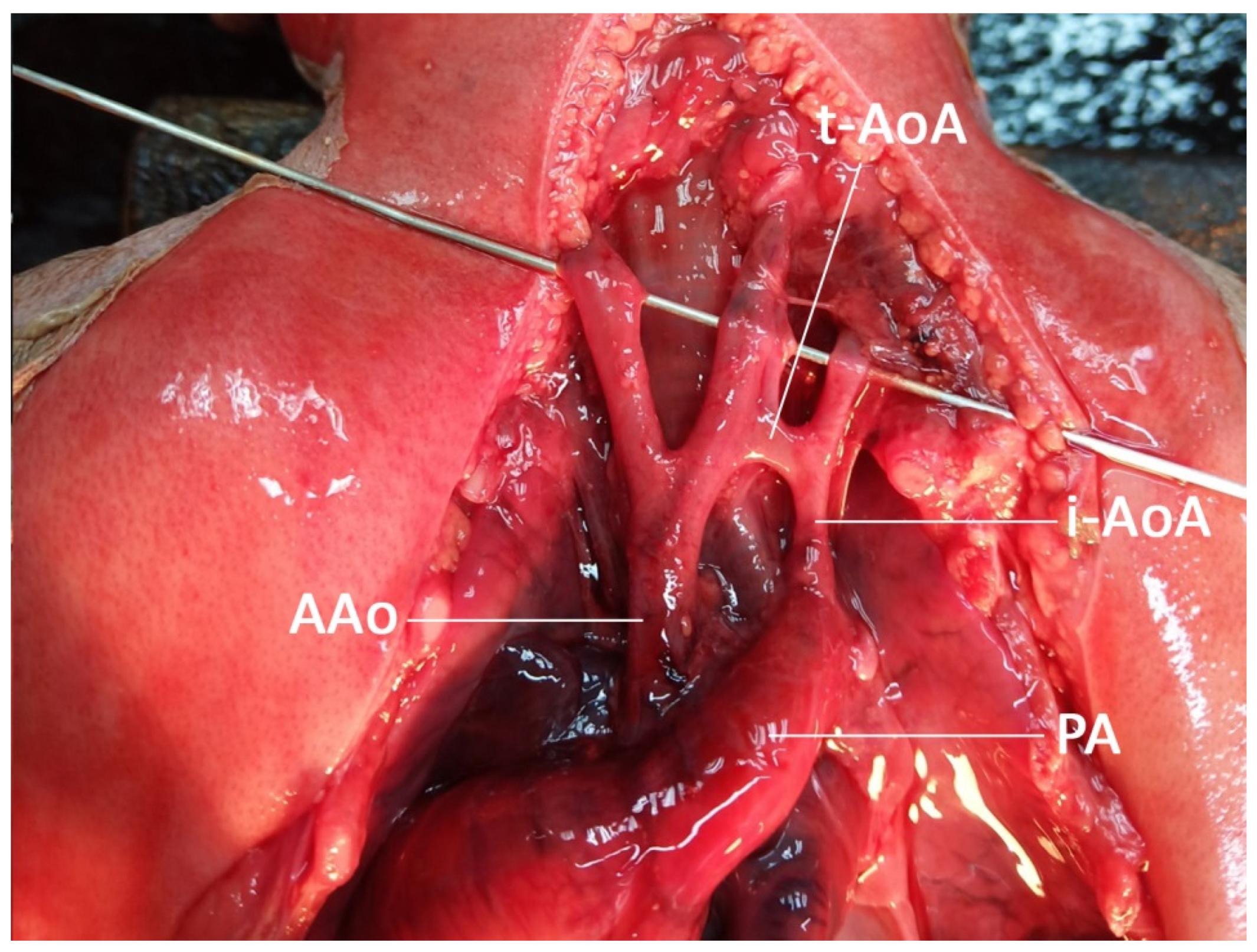 Diagnostics 12 00421 g004 Diagnostics 12 00421 g004
